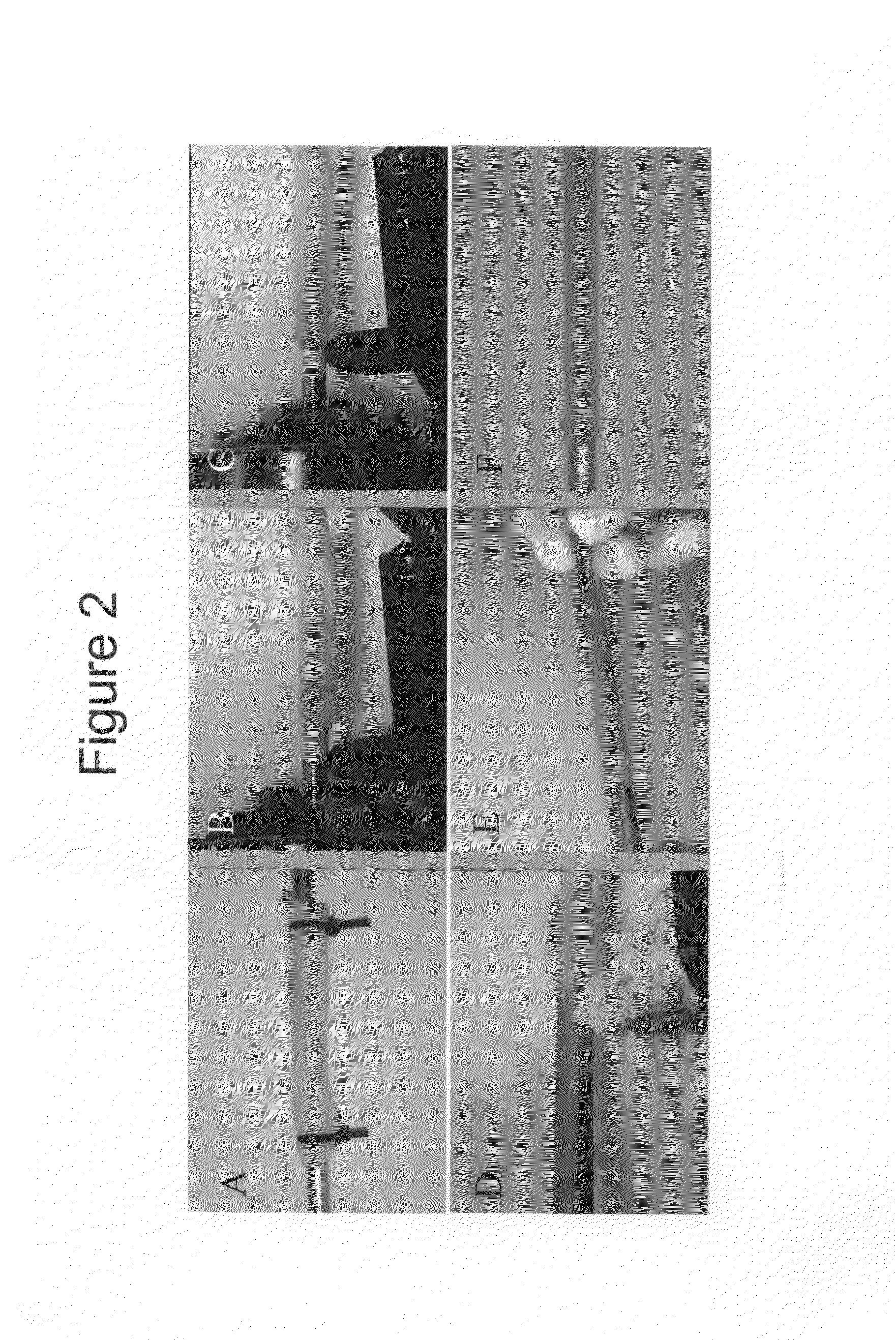 Decellularized grafts from umbilical cord vessels and process for preparing and using same