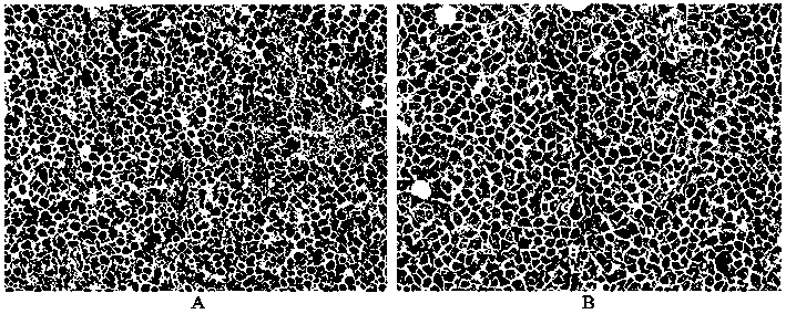 Ulvan composition with anti-tumor activity and preparation method thereof