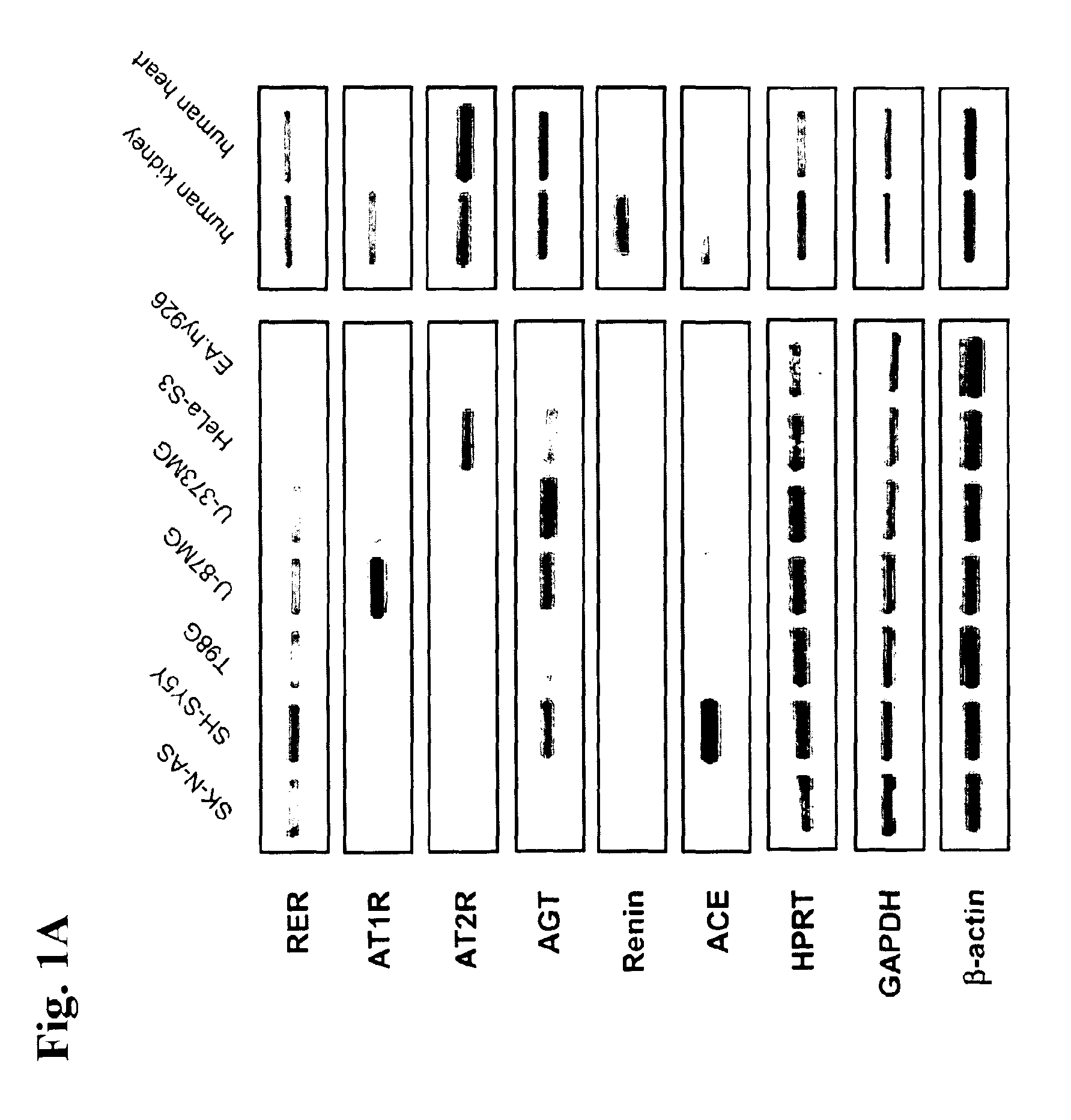 Determination of renin-prorenin receptor activity