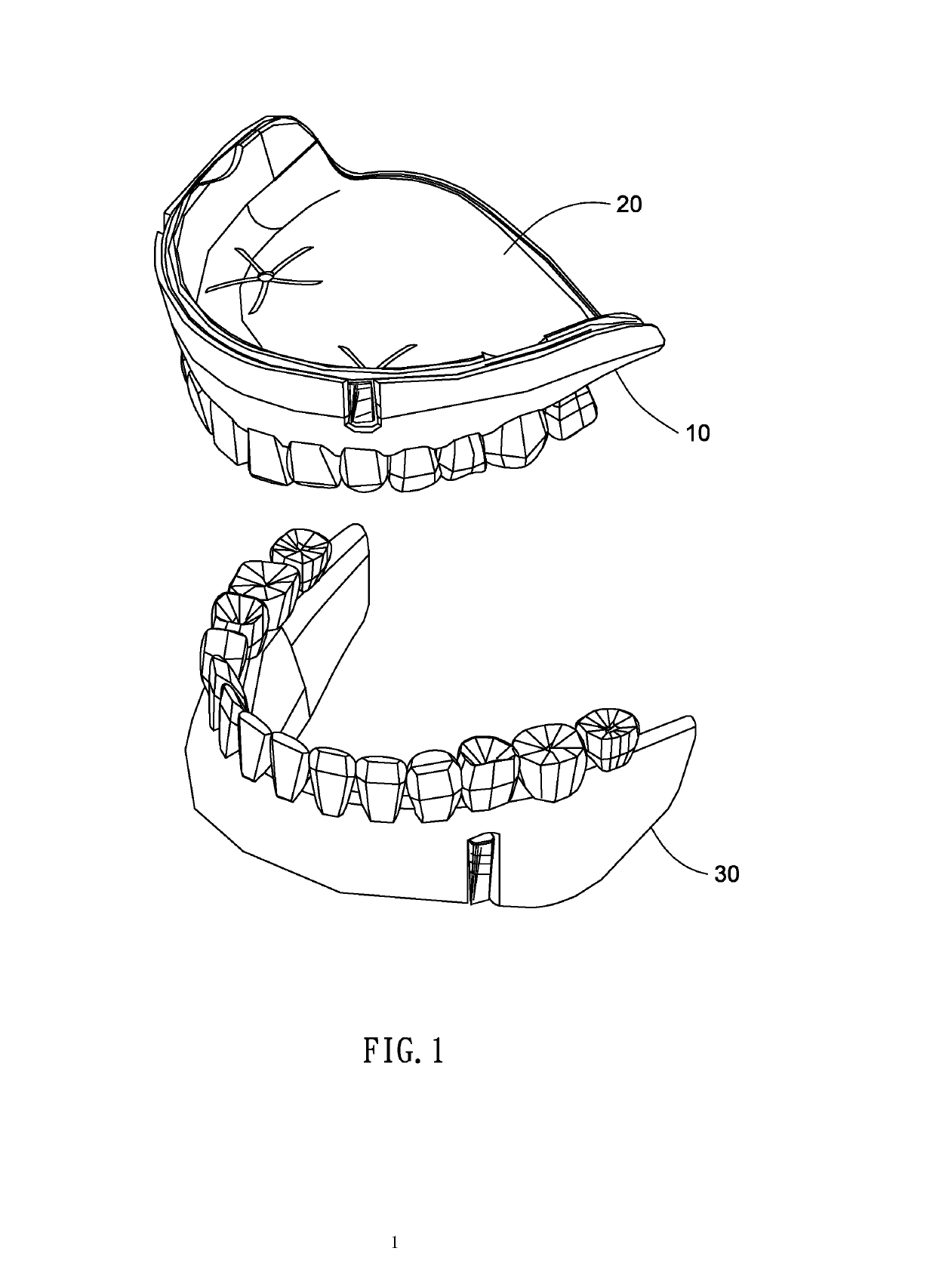 Removable denture