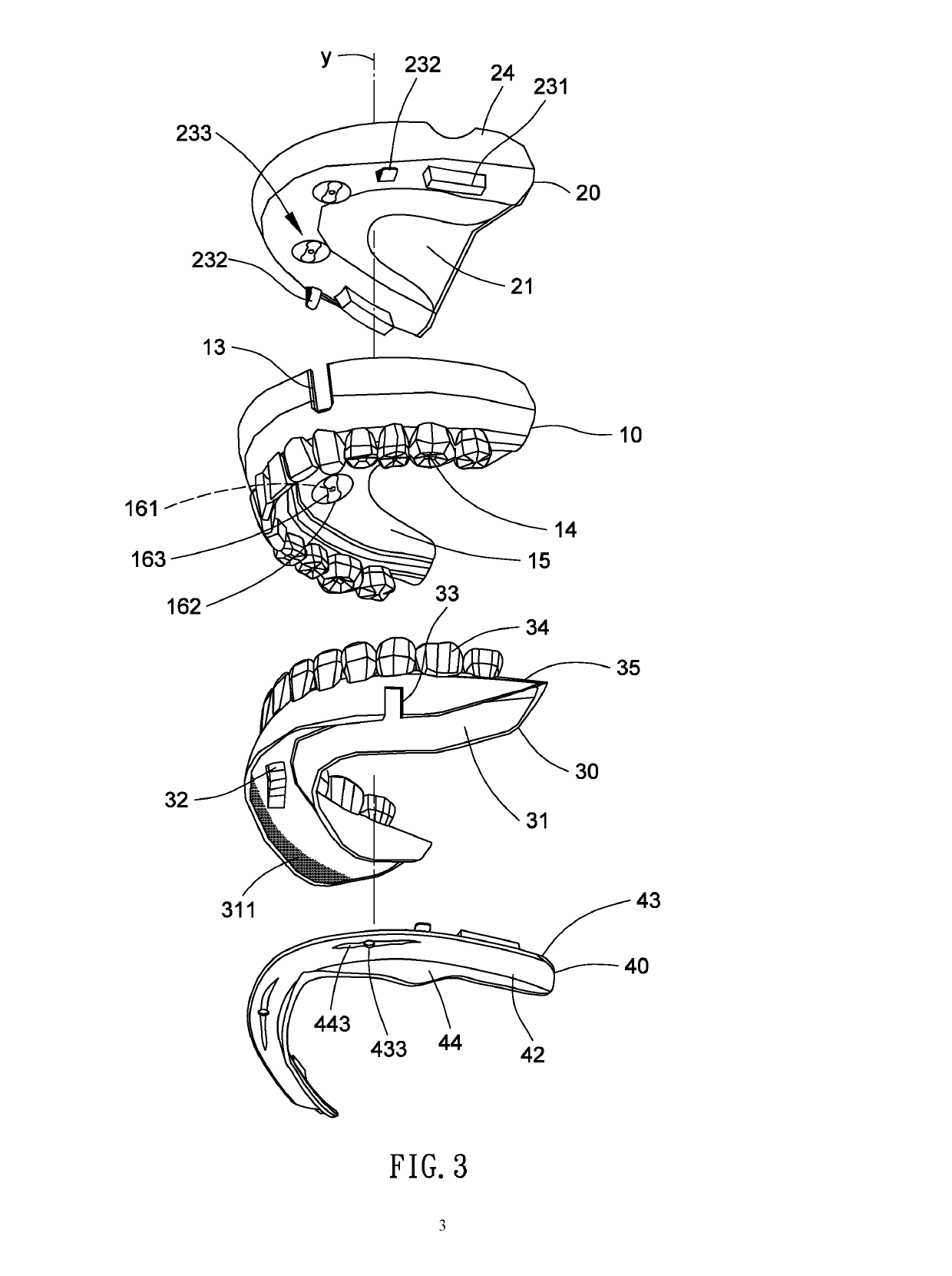 Removable denture