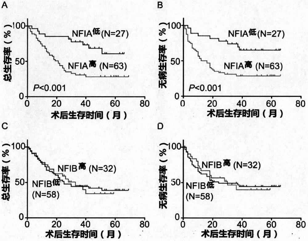 Application of nfi transcription factor in esophageal squamous cell carcinoma