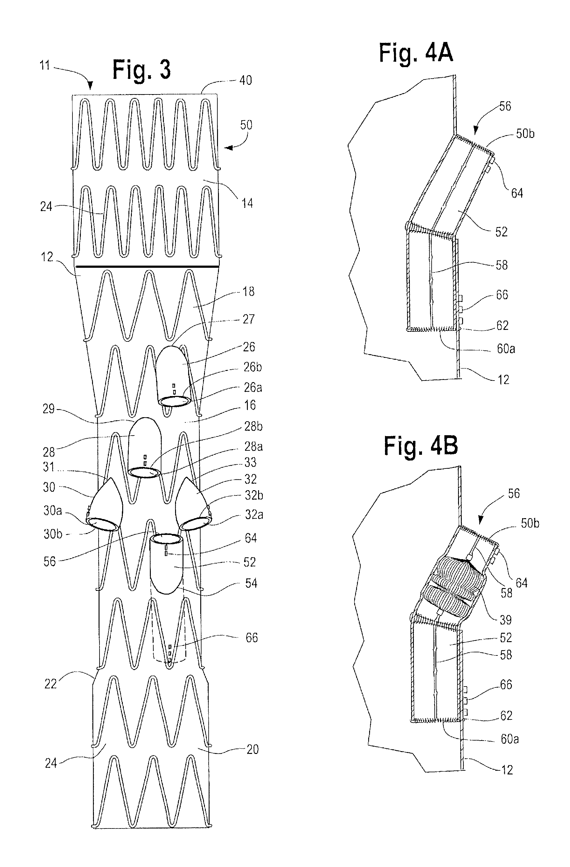 Paraplegia prevention stent graft