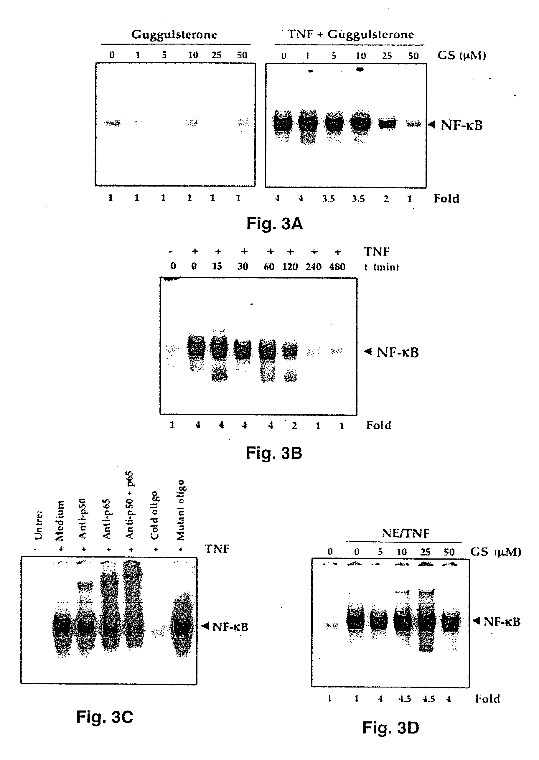 Guggulsterone: an inhibitor of nuclear factor - kappaB and IkappaBalpha kinase activation and uses thereof