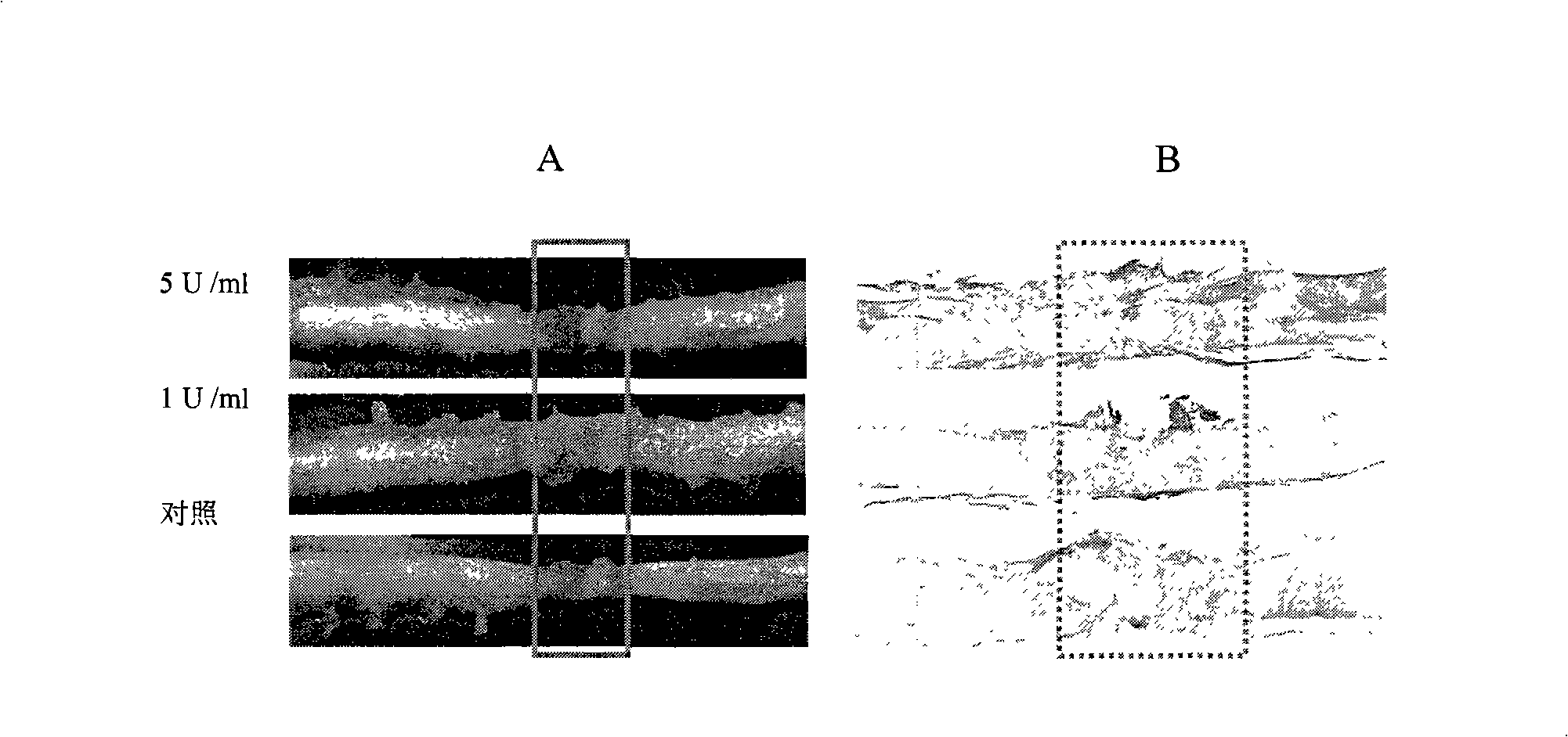 Pharmaceutical composition for promoting axon regeneration after spinal cord damage and behavior function recovery