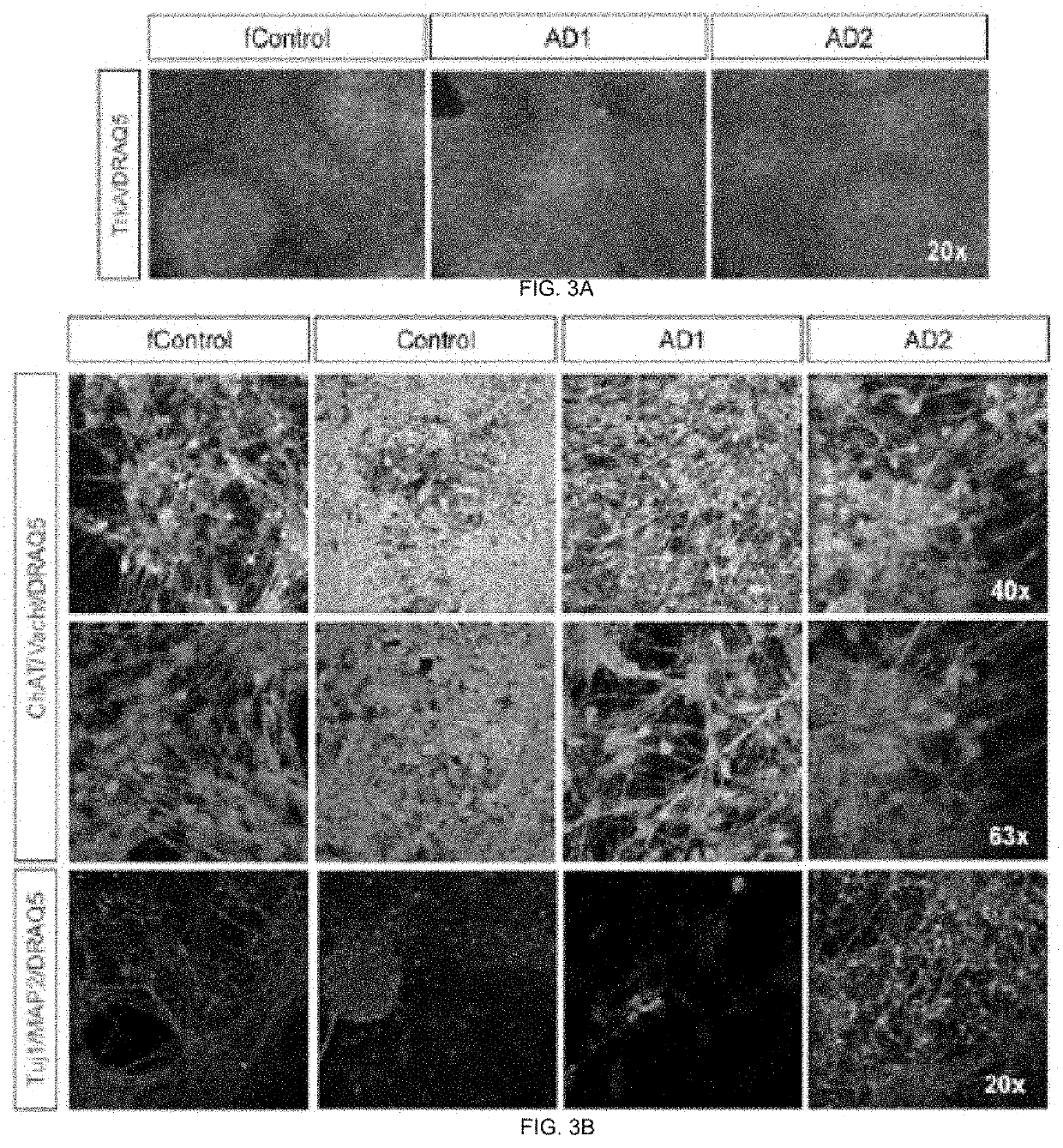 METHOD AND COMPOSITION FOR GENERATING BASAL FOREBRAIN CHOLINERGIC NEURONS (BFCNs)