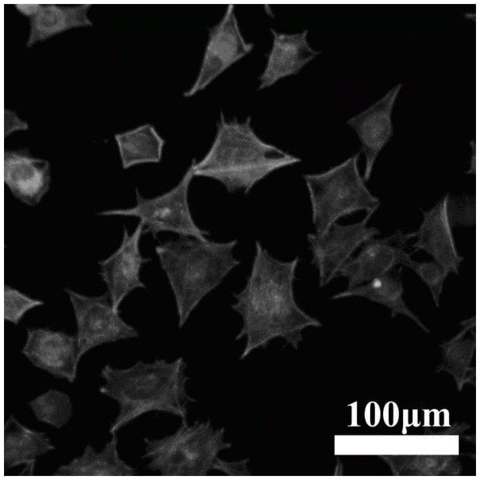 Preparation method and application of composite hydrogel, composite hydrogel repair material and preparation method of composite hydrogel repair material