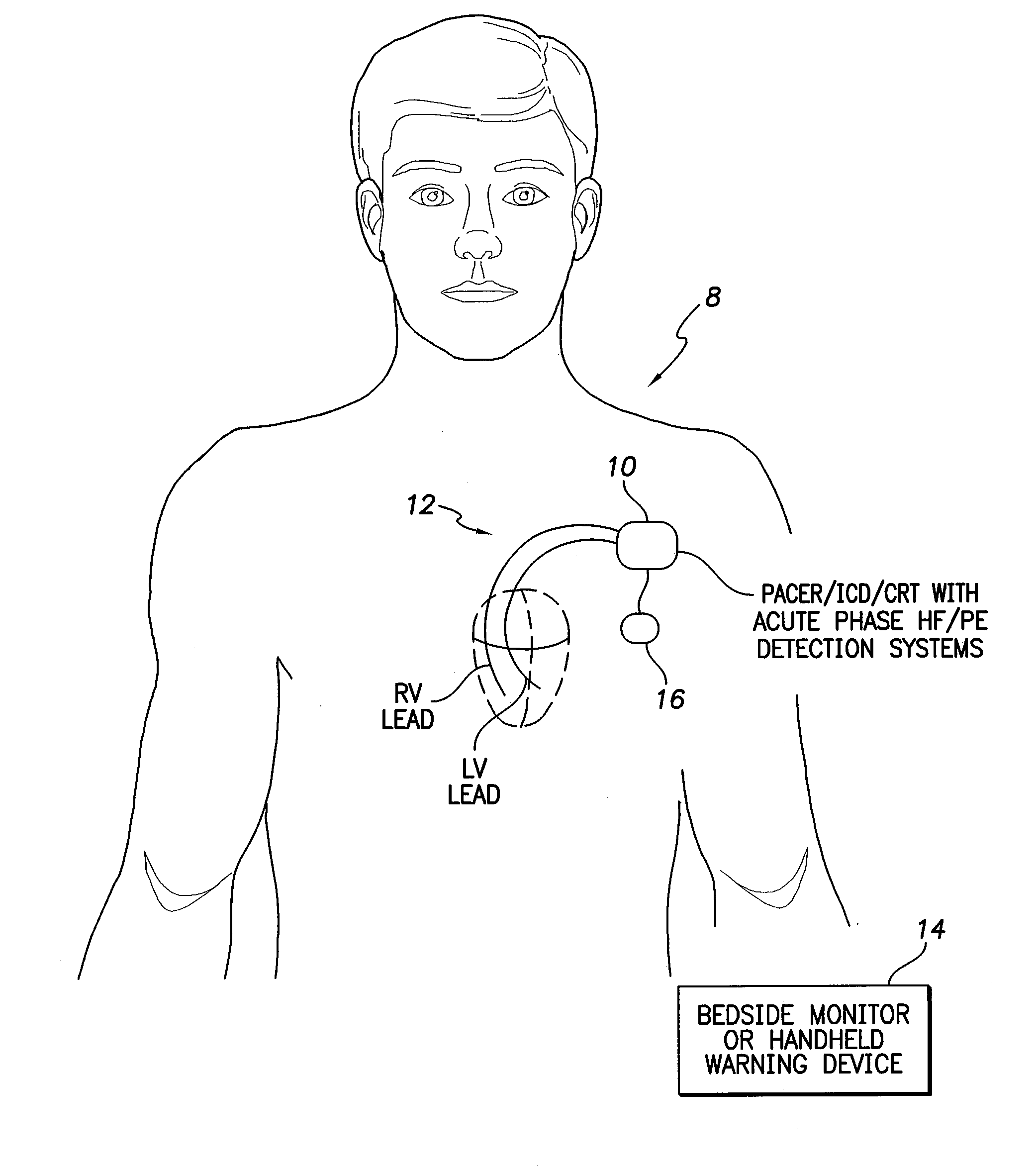 Systems and Methods for Activating and Controlling Impedance-Based Detection Systems of Implantable Medical Devices