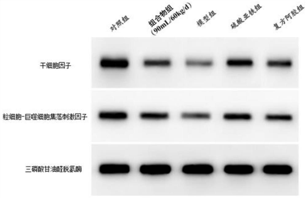 Application of composition to preparation of medicine for treating iron-deficiency anemia