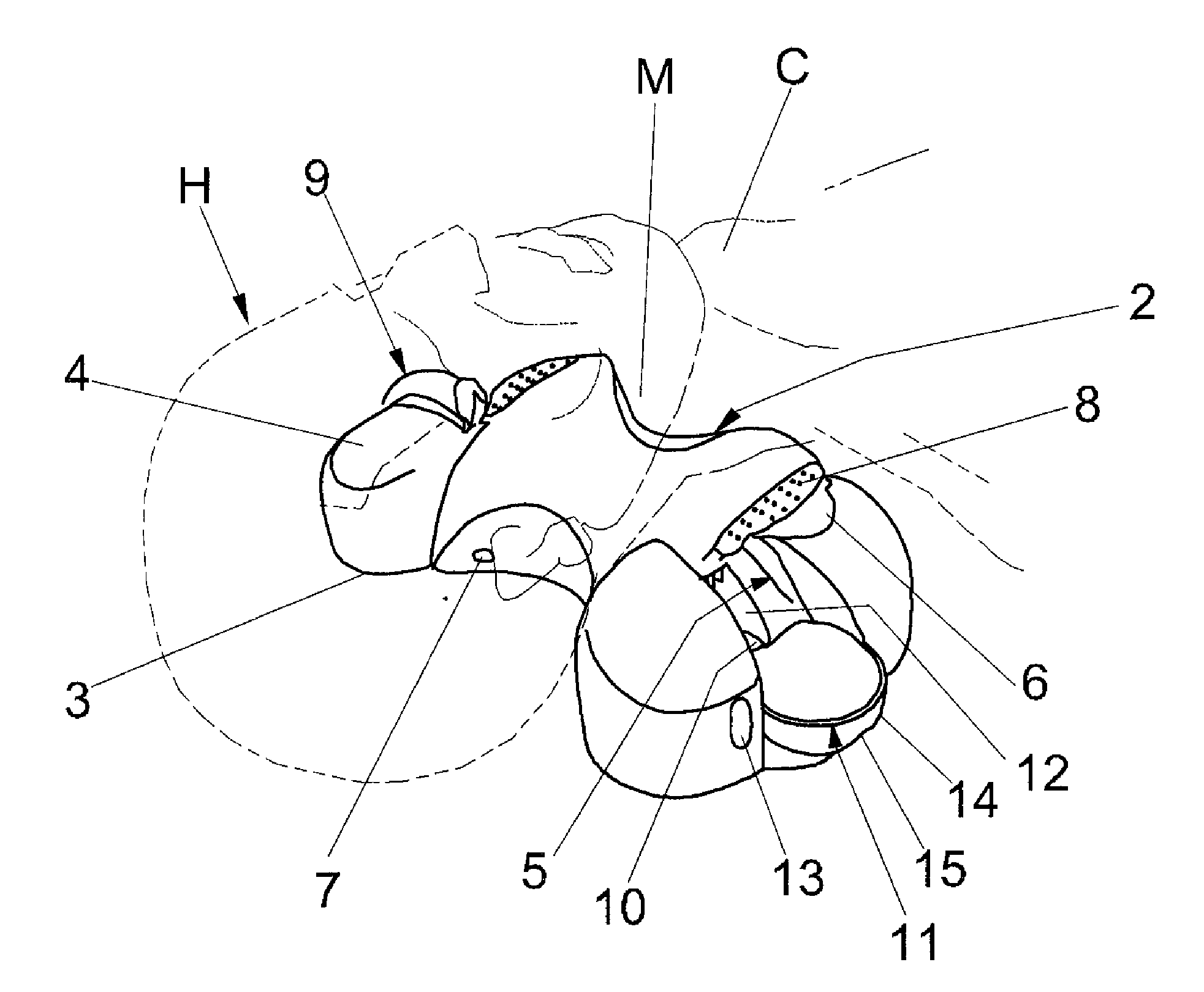 Mandibular and neck support and positioning device