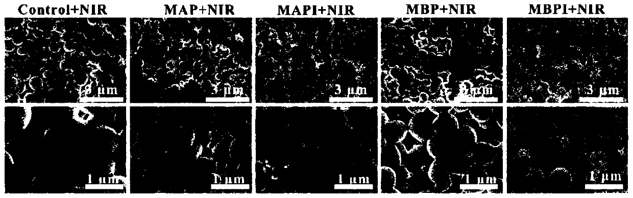 Nano composite material based on enzyme degradation enhanced photo-thermal removal of bacterial biofilms, and preparation method and application of nano composite material