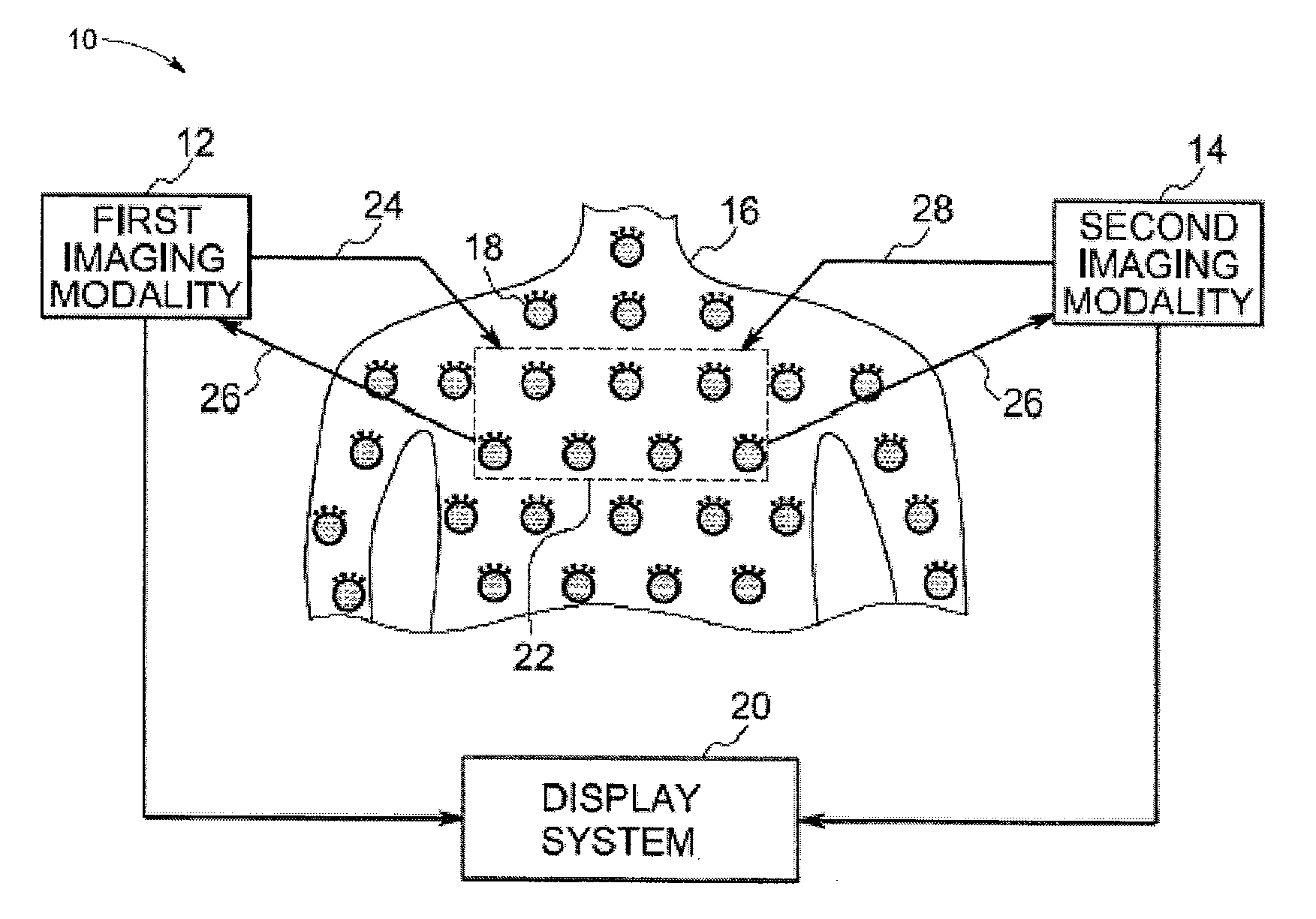 Contrast agent for combined modality imaging and methods and systems thereof