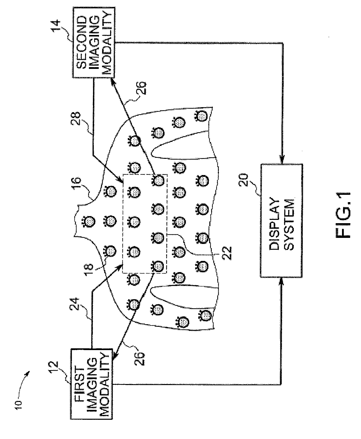 Contrast agent for combined modality imaging and methods and systems thereof