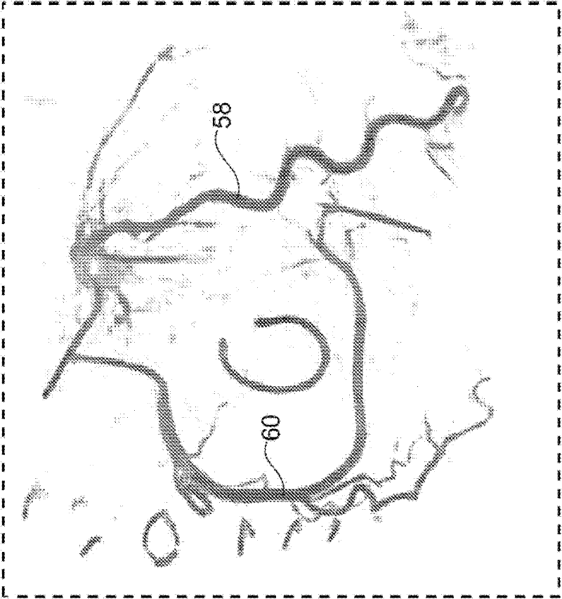 Visualization of the coronary artery tree