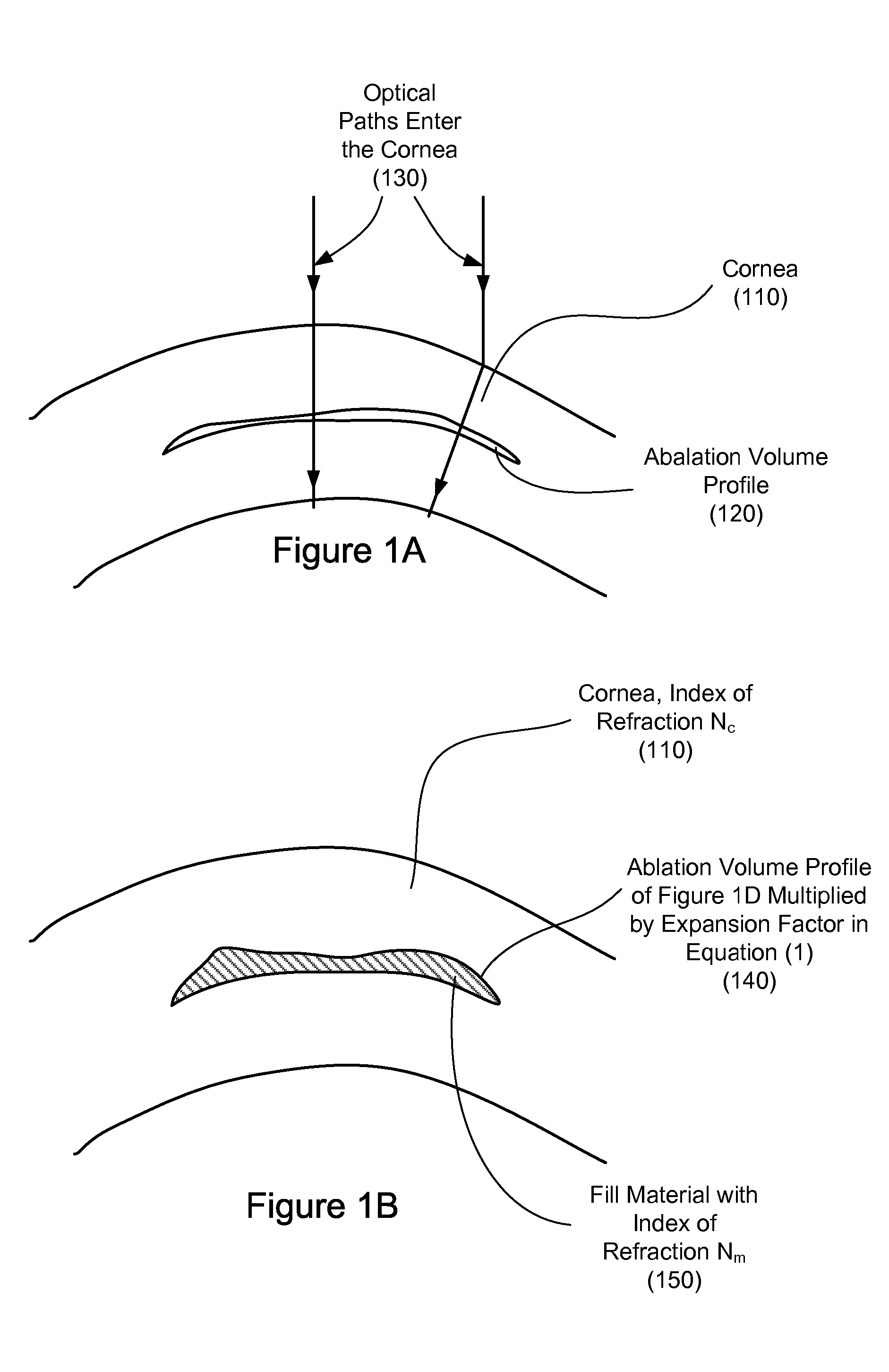 Intrastromal Surgery Correcting Low Order and High Order Aberrations