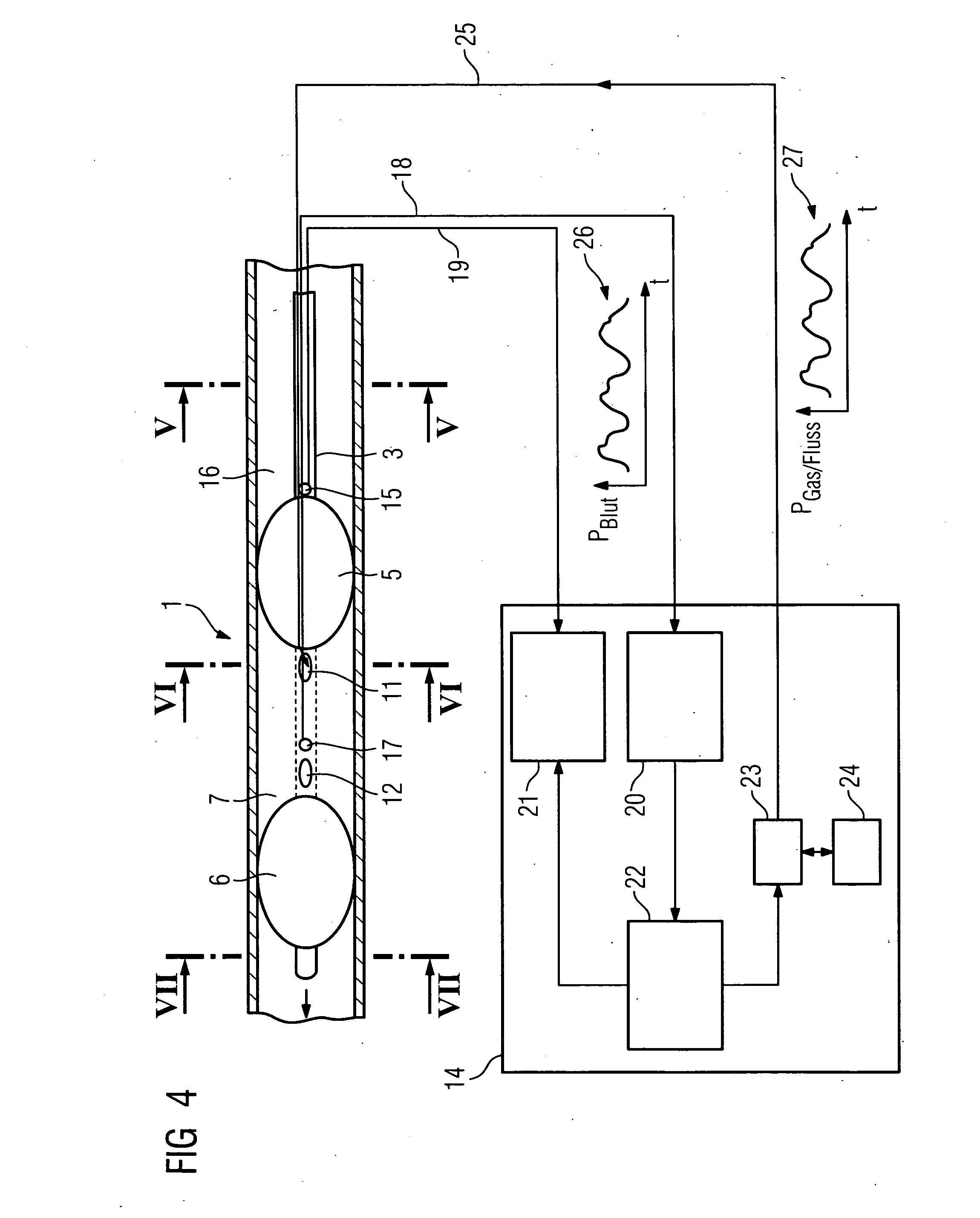 Catheter device