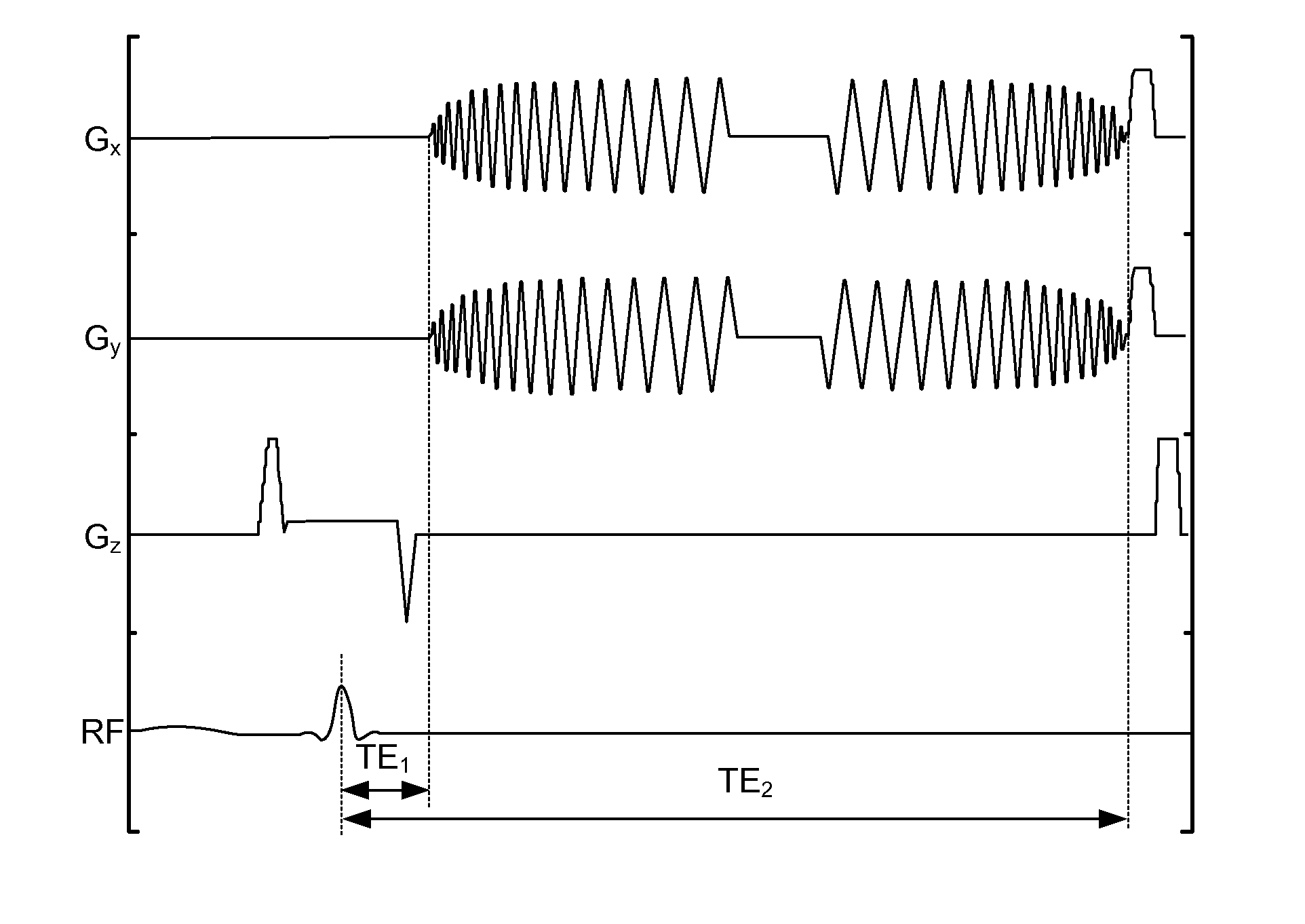 Dual gradient echo pulse sequence using interleaved spiral-out spiral-in k-space trajectories