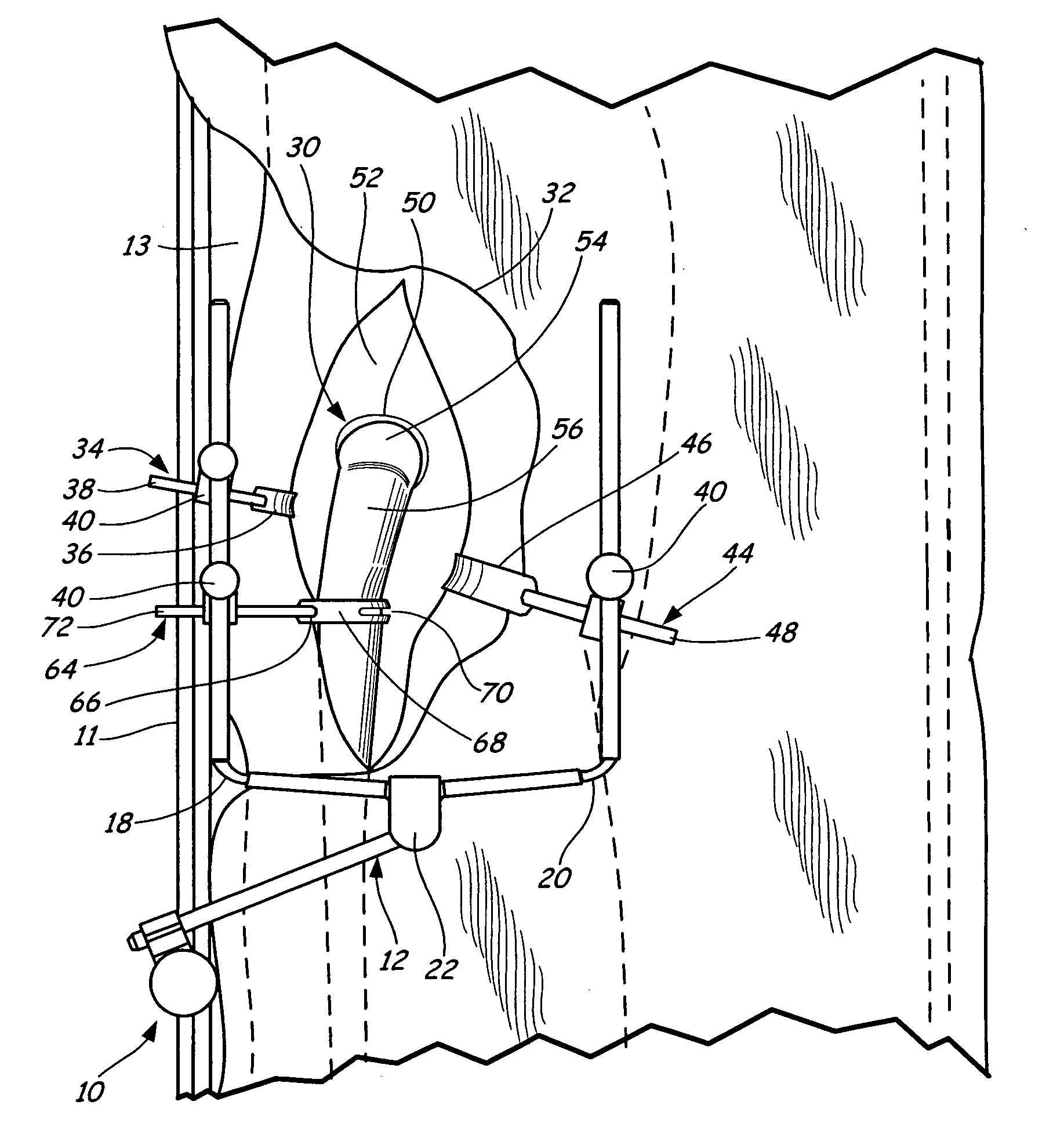 Method of table mounted retraction in hip surgery