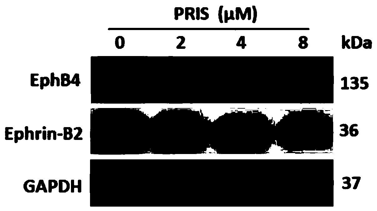 New drug use of pristimerin