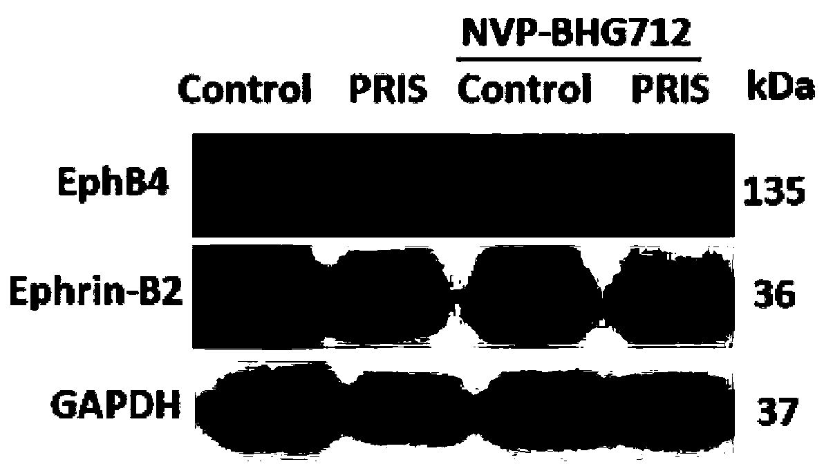 New drug use of pristimerin