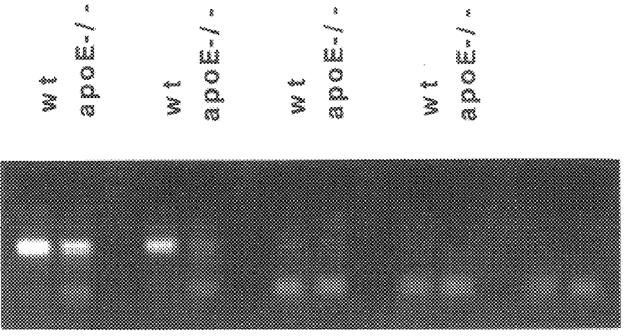 Compositions and methods for the treatment and diagnosis of cardiovascular disease using rchd528 as a target