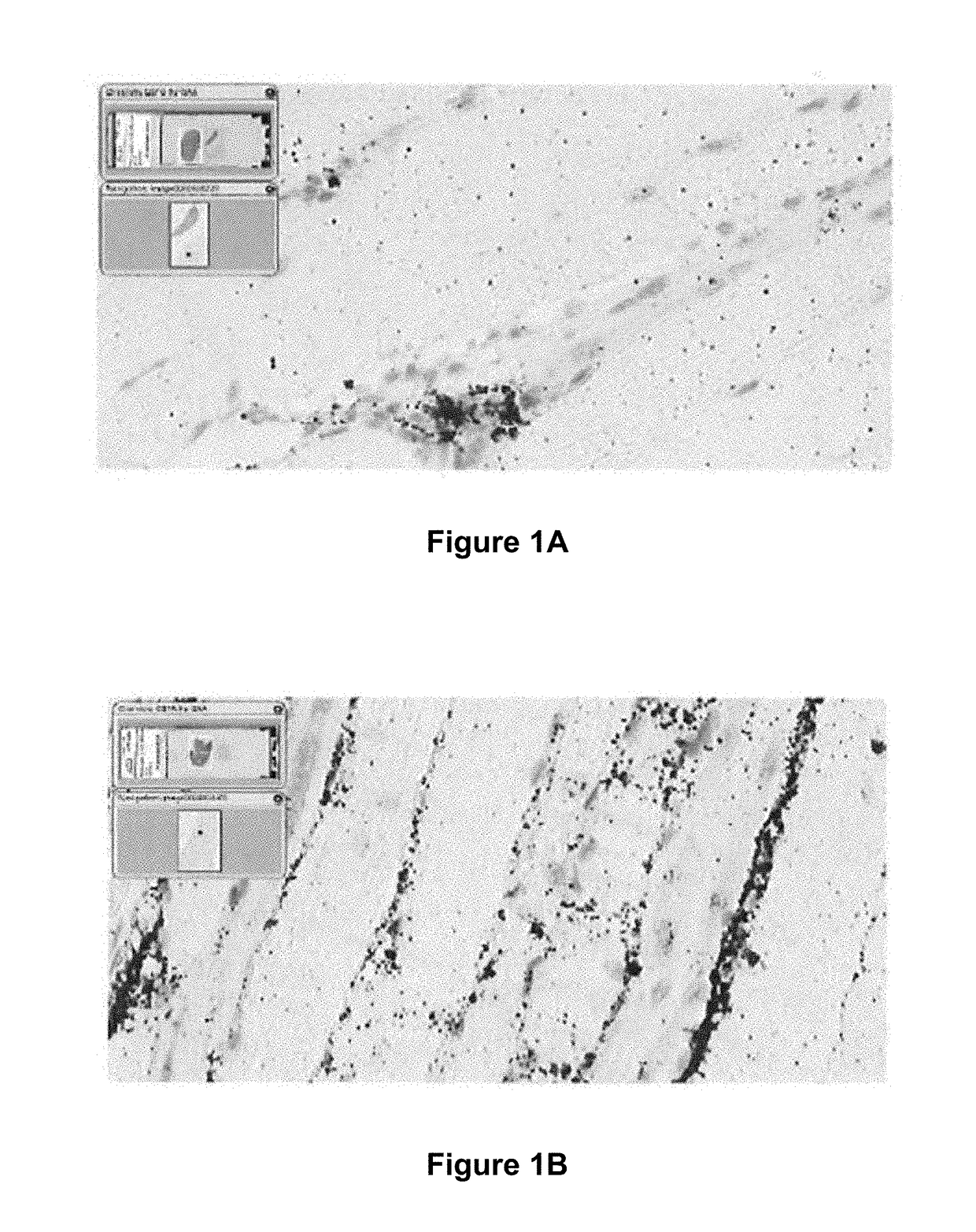 MRNA therapy for pompe disease