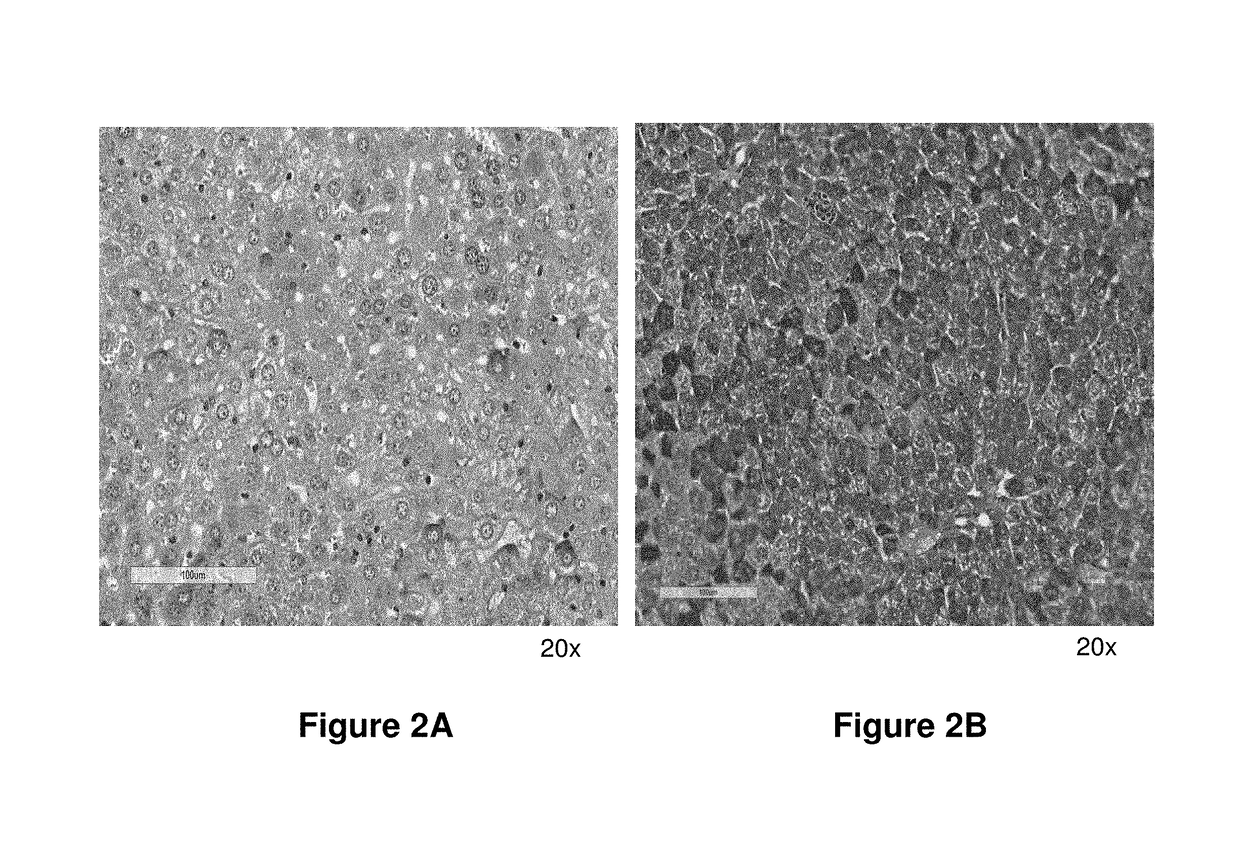 MRNA therapy for pompe disease