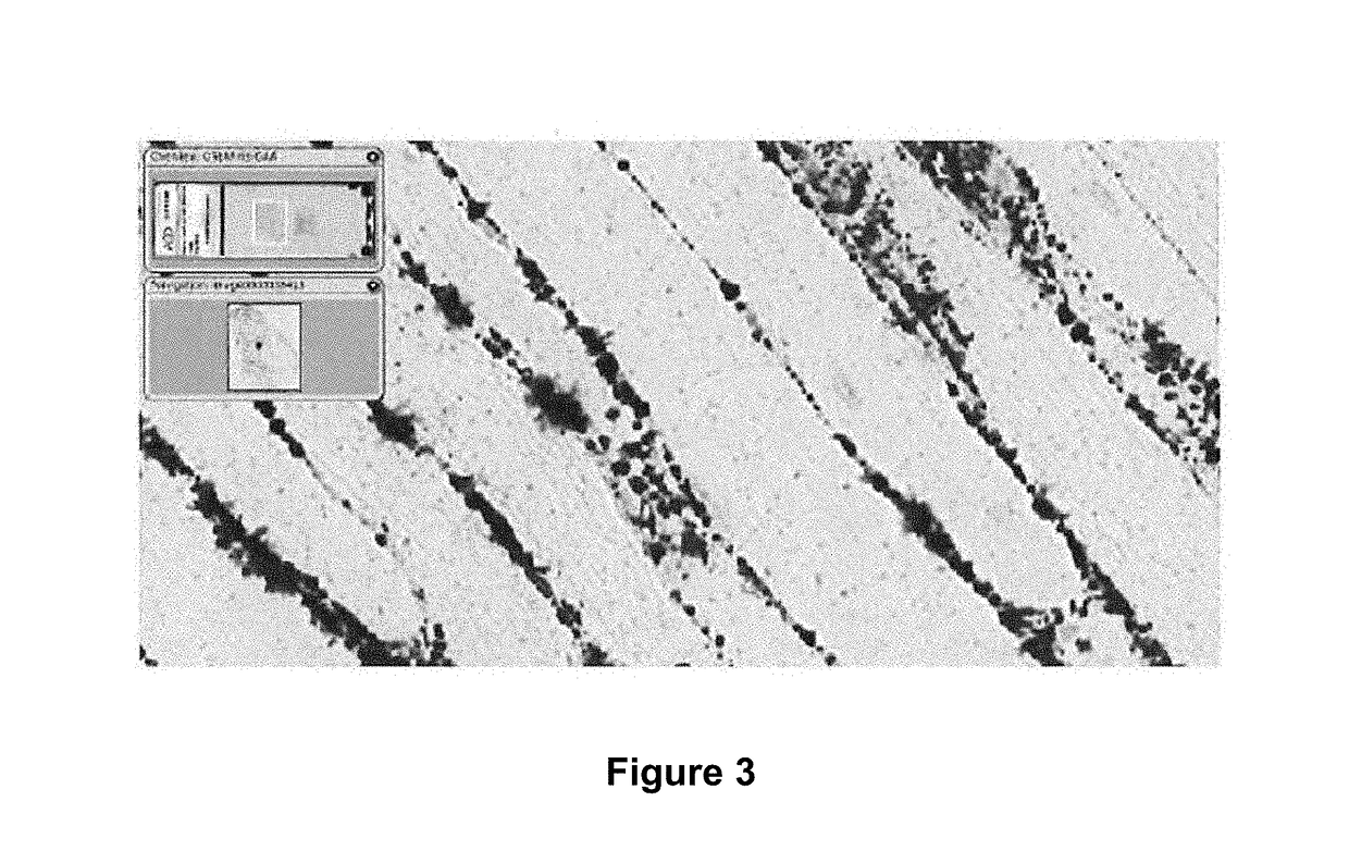 MRNA therapy for pompe disease