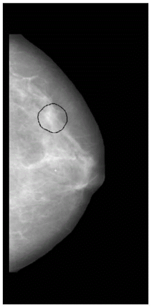 Mammary X-ray image enhancement method