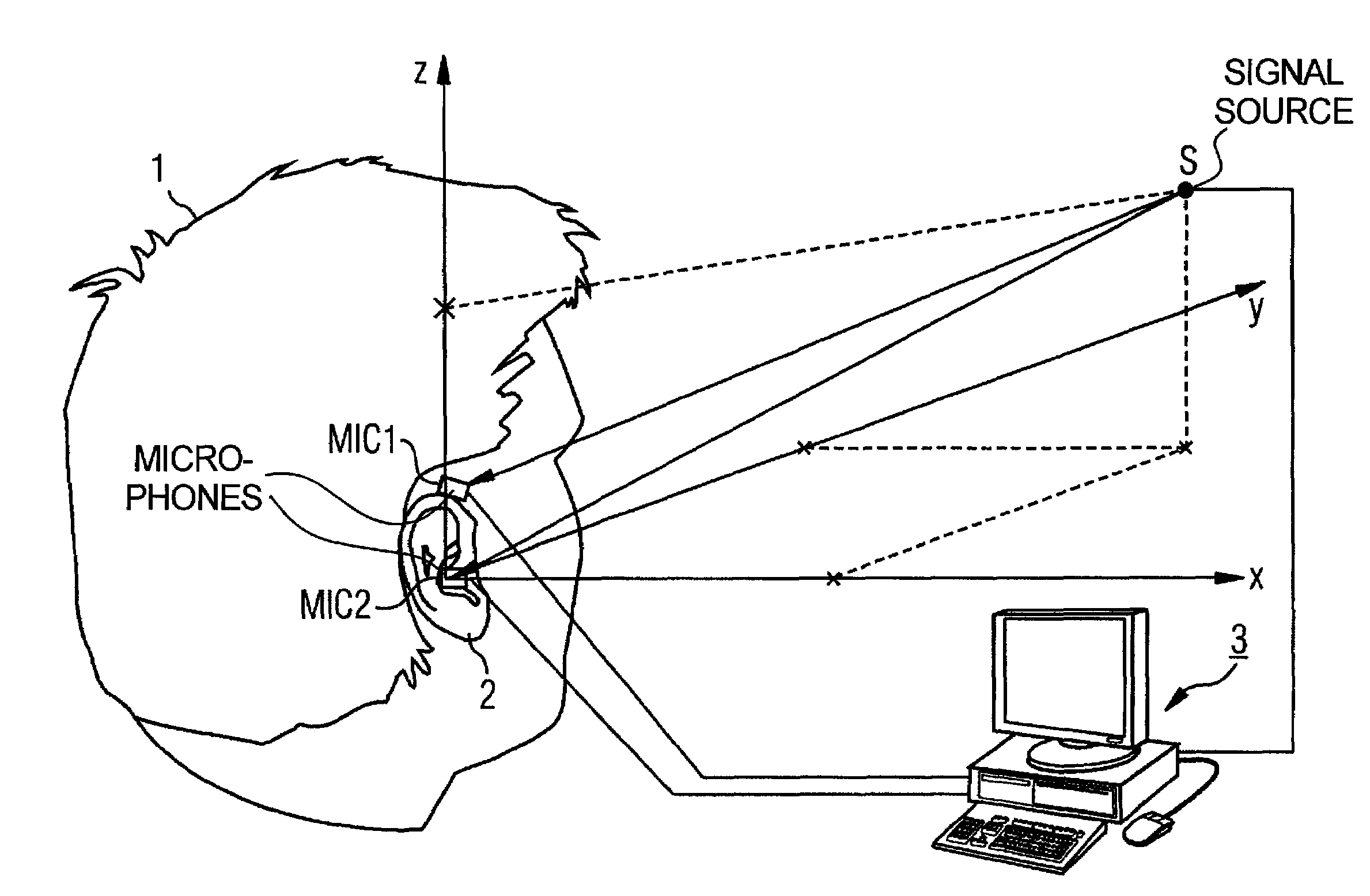 Hearing aid device, and operating and adjustment methods therefor, with microphone disposed outside of the auditory canal