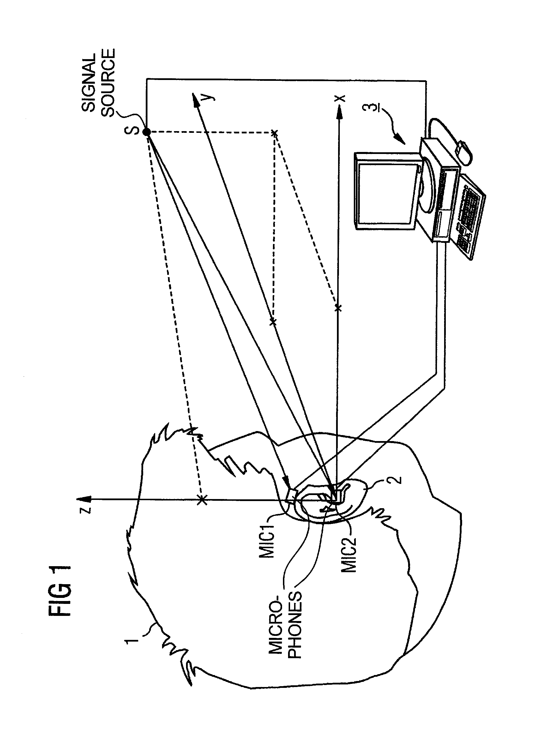 Hearing aid device, and operating and adjustment methods therefor, with microphone disposed outside of the auditory canal