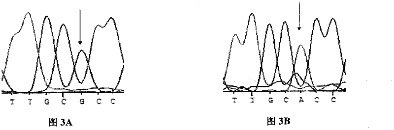 Molecular marker related to porcine leukocyte count and application of molecular marker