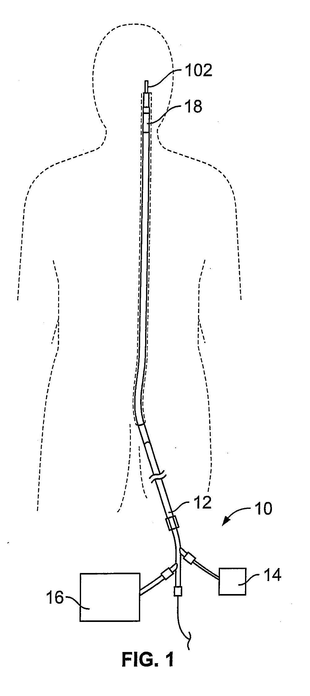 Methods for restoring blood flow within blocked vasculature