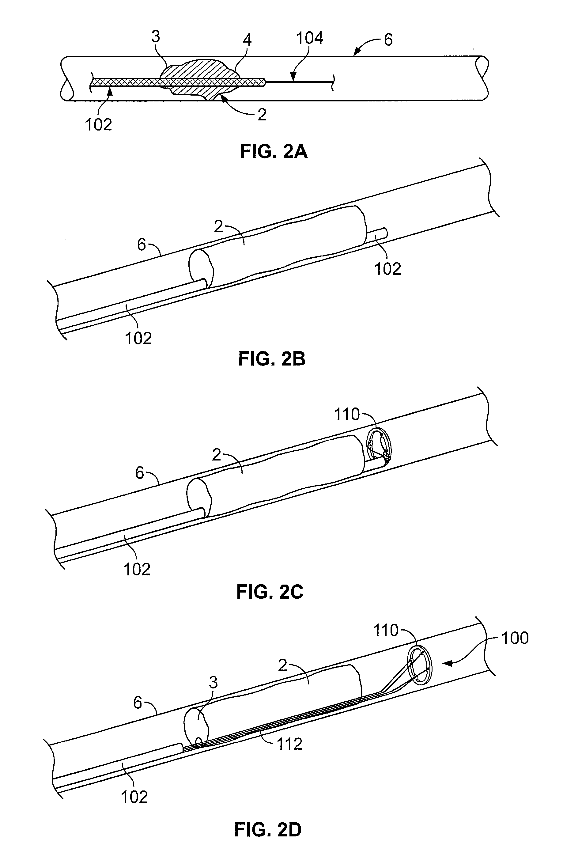 Methods for restoring blood flow within blocked vasculature