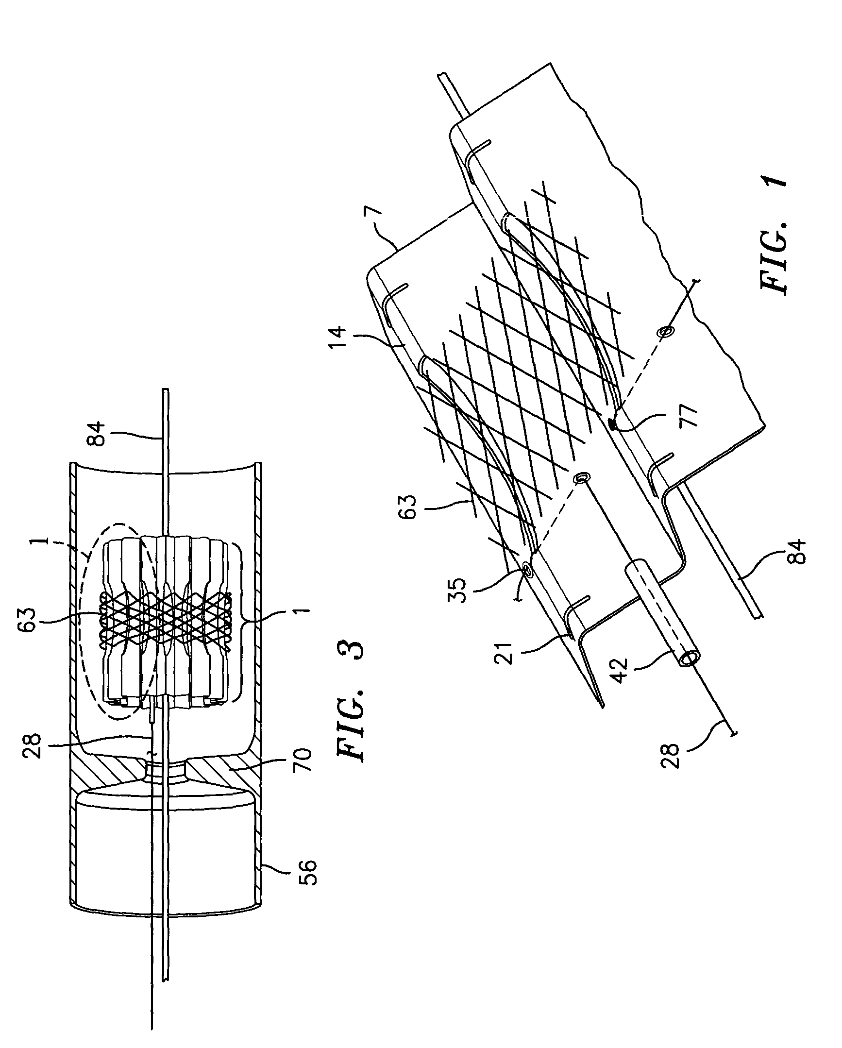 Flow maintaining stent delivery system