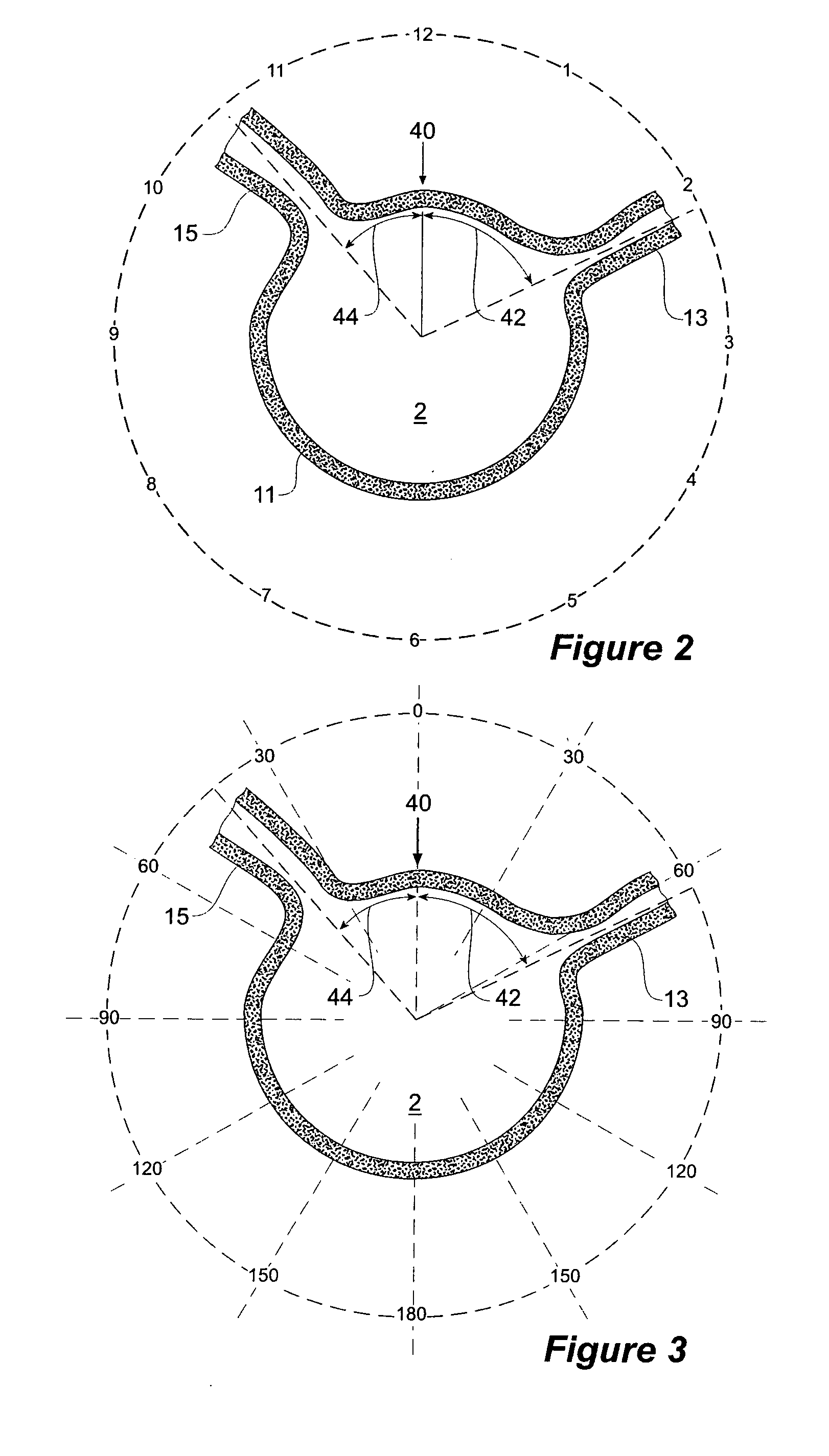 Design and assembly of fenestrated stent grafts