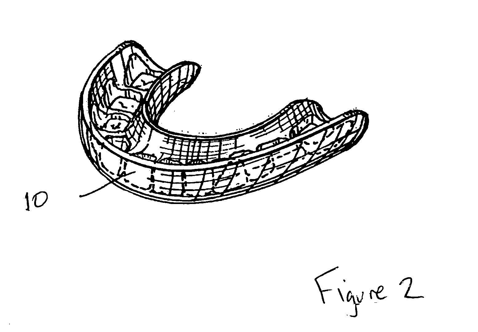 System and method for fabricating an interim dental guard device