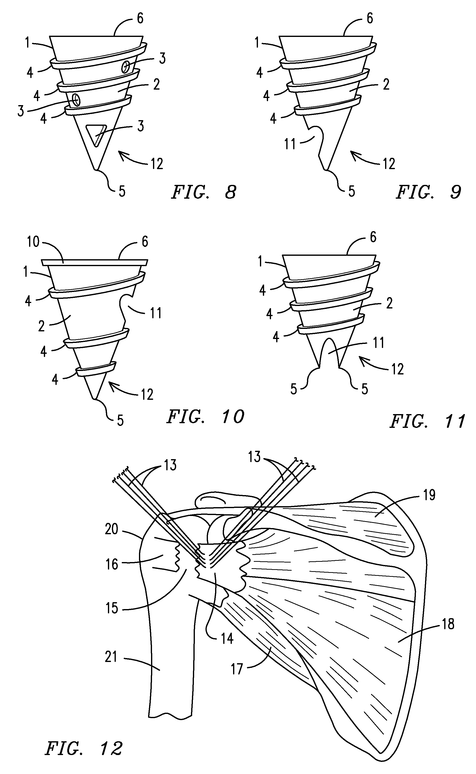 Fixation suture device and method