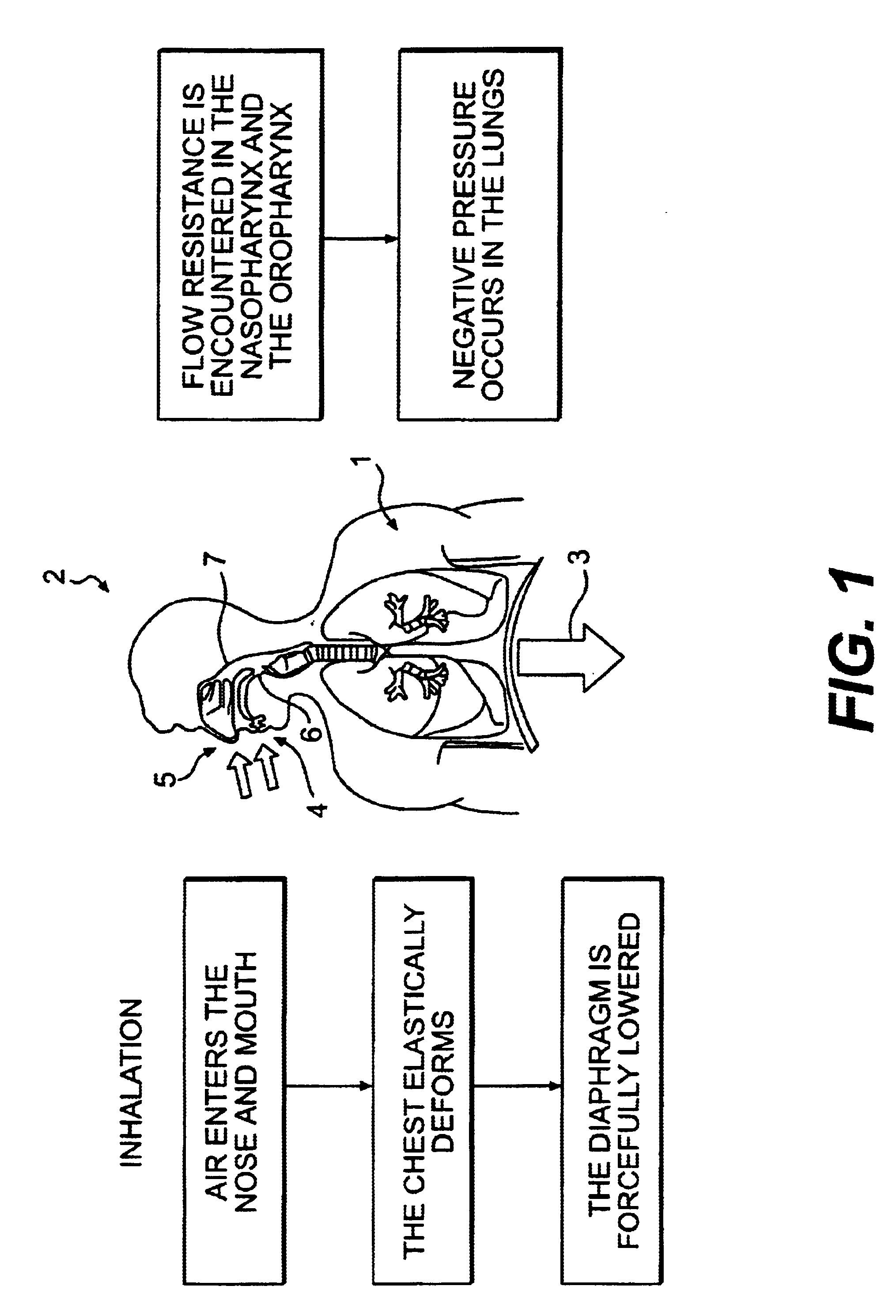 Mechanical lungs