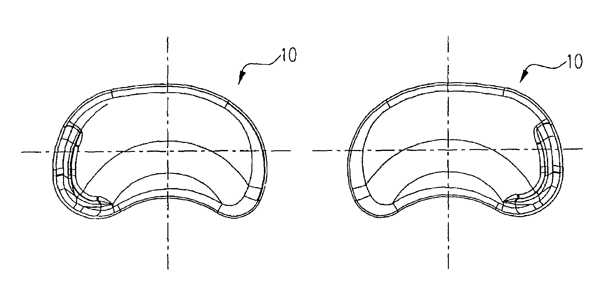 Method and system for mammalian joint resurfacing