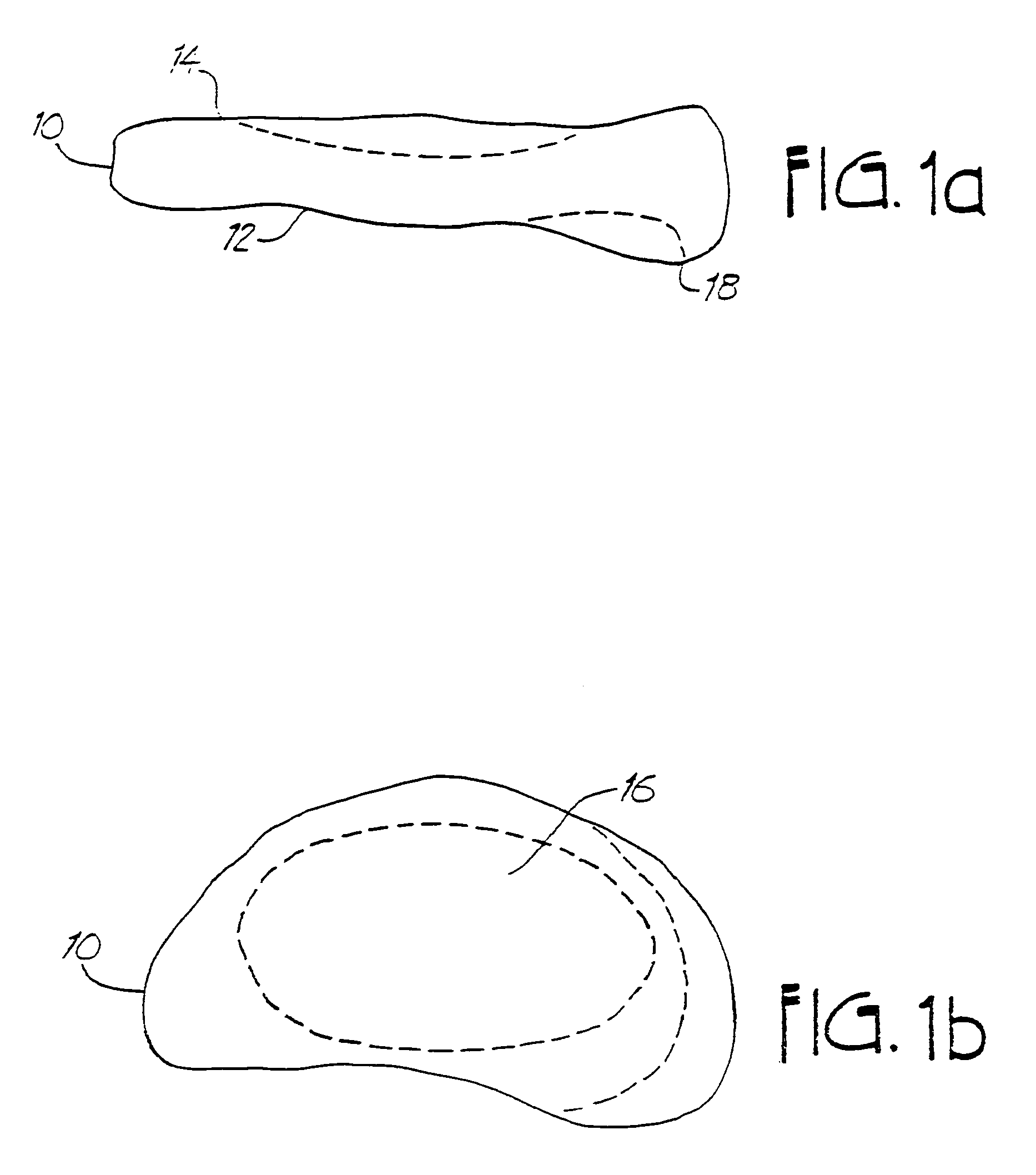 Method and system for mammalian joint resurfacing