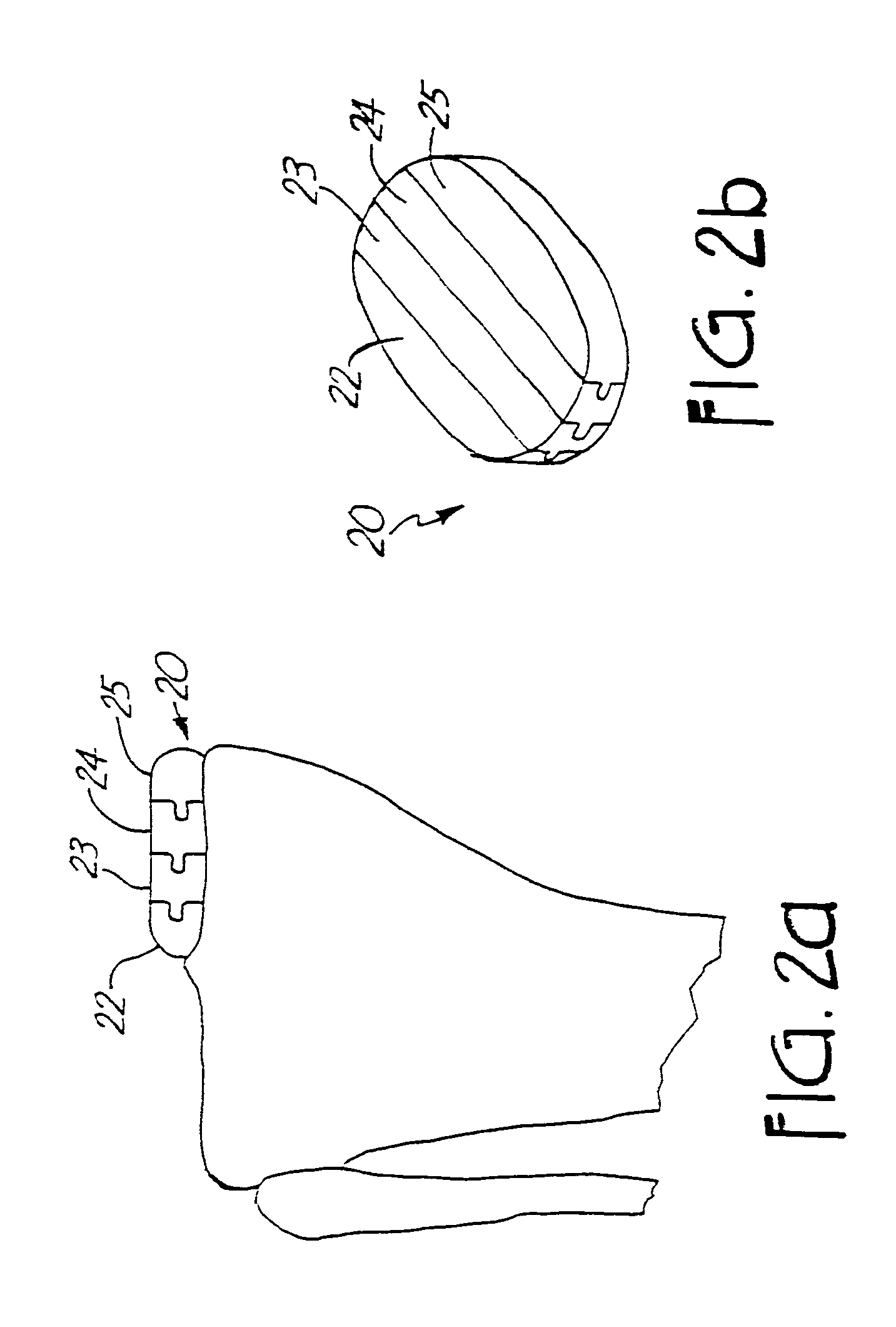 Method and system for mammalian joint resurfacing