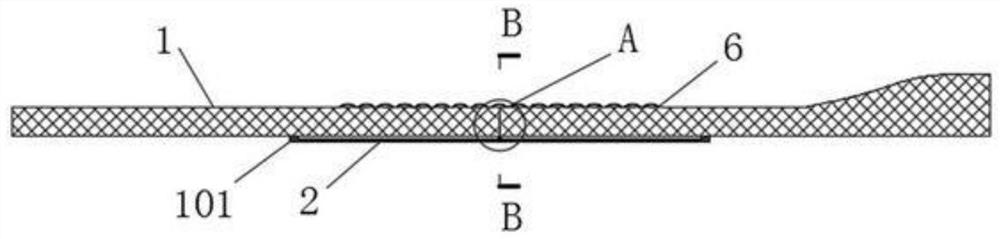 Rehabilitation treatment auxiliary device for nursing of leg fracture patient