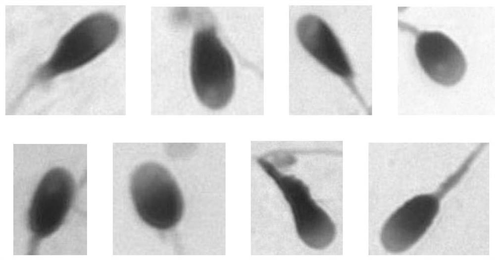 Automatic sperm morphology analysis method based on multi-scale feature fusion