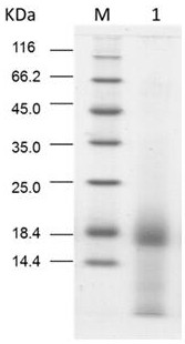 Application of a kind of angelica protein in the preparation of liver injury protection medicine