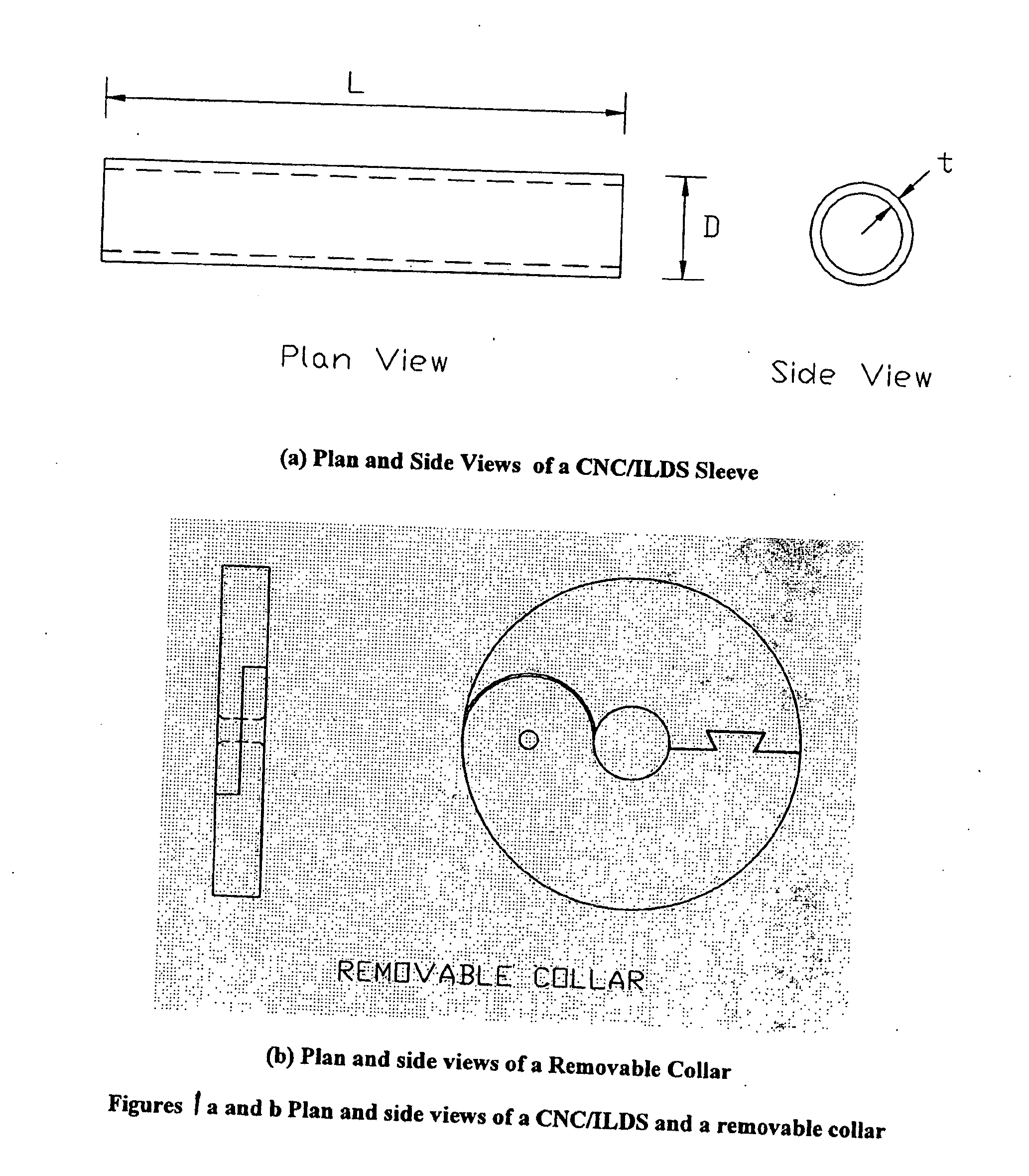 CNC impact load deflector sleeve and removable collar for cable and post protection