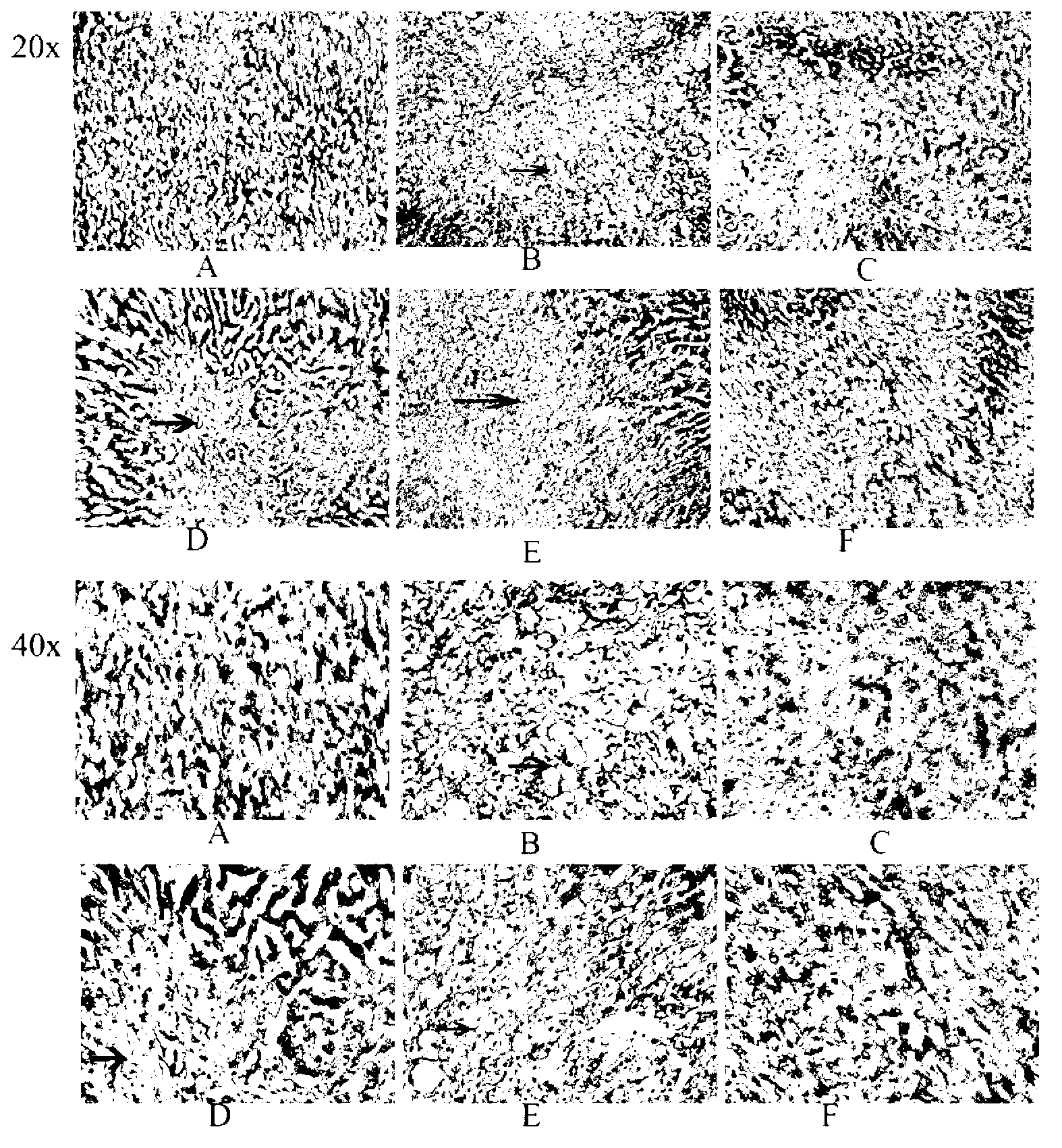 Purposes of artemisinin compounds in preparing anti-atherosclerotic medicaments