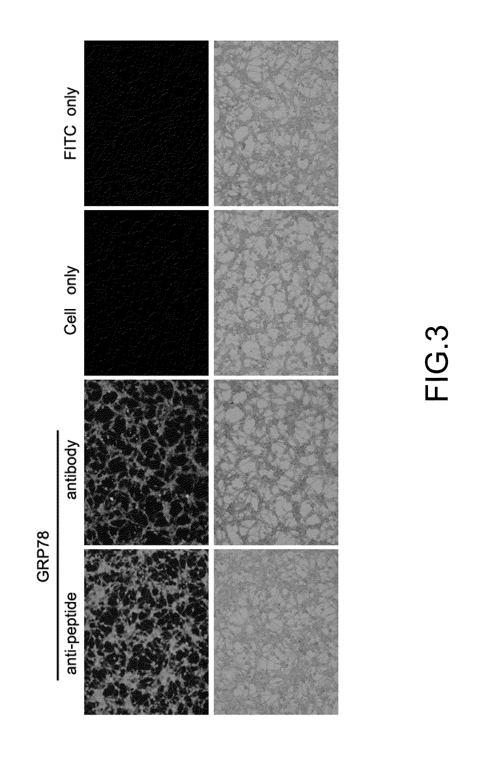 Method of colorectal cancer detection by using radiolabeled anti-GRP78 peptide