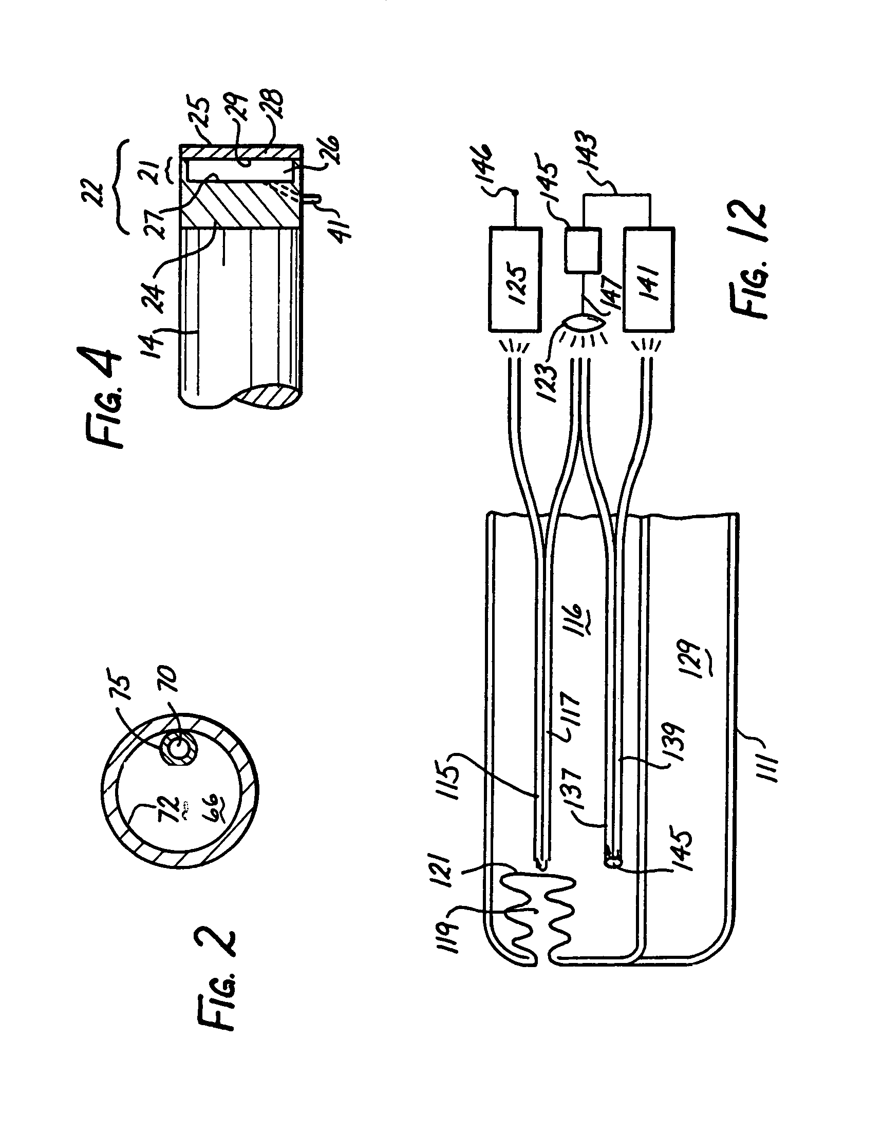 Intracranial pressure monitor and drainage catheter assembly