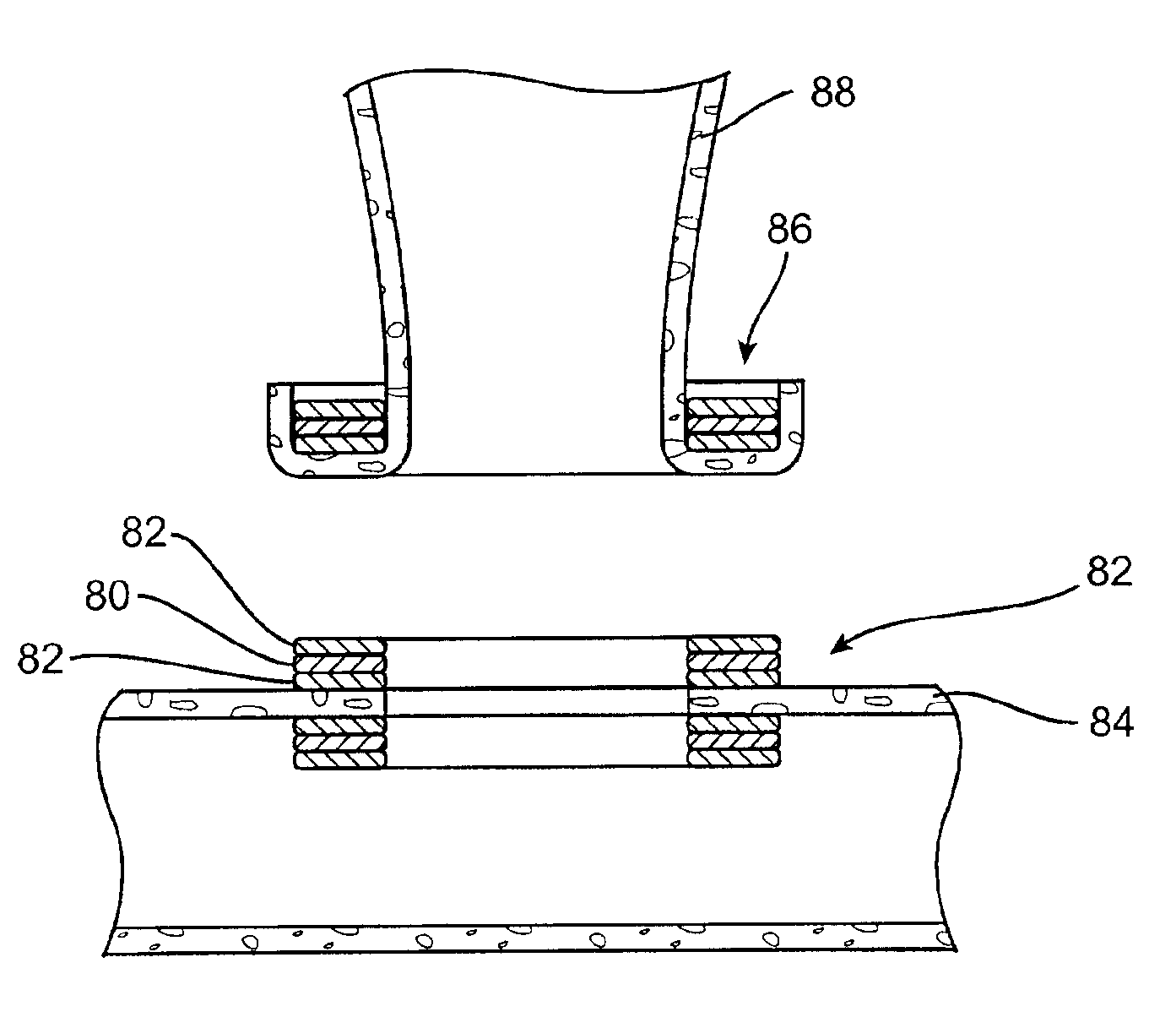 Methods and devices using magnetic force to form an anastomosis between hollow bodies